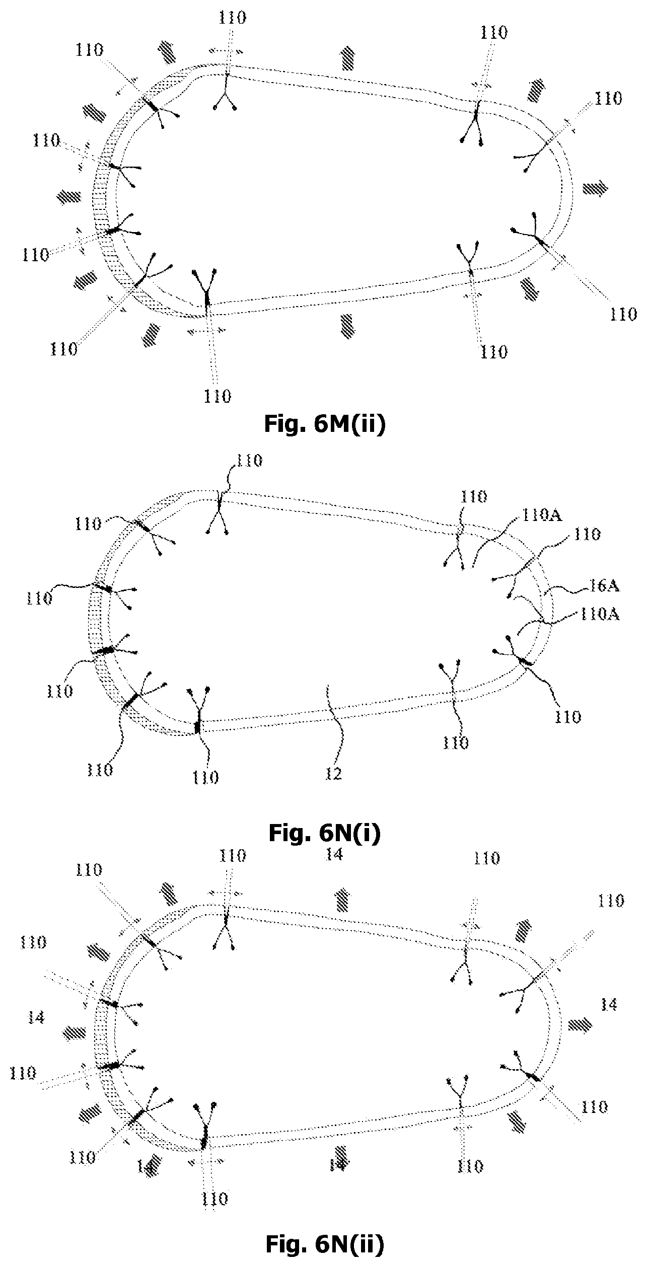 Patent US12342905 Figure 13 – Expandable shoe capable to grow with a wearer/user's feet for more than three sizes
