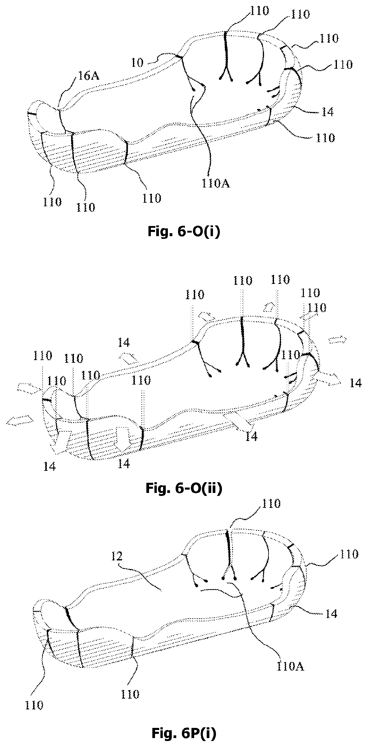 Patent US12342905 Figure 14 – Expandable shoe capable to grow with a wearer/user's feet for more than three sizes