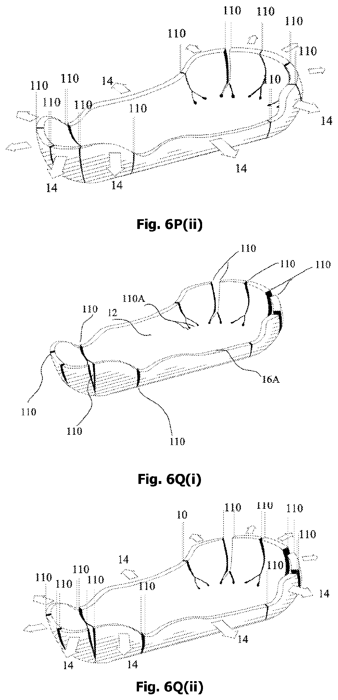 Patent US12342905 Figure 15 – Expandable shoe capable to grow with a wearer/user's feet for more than three sizes