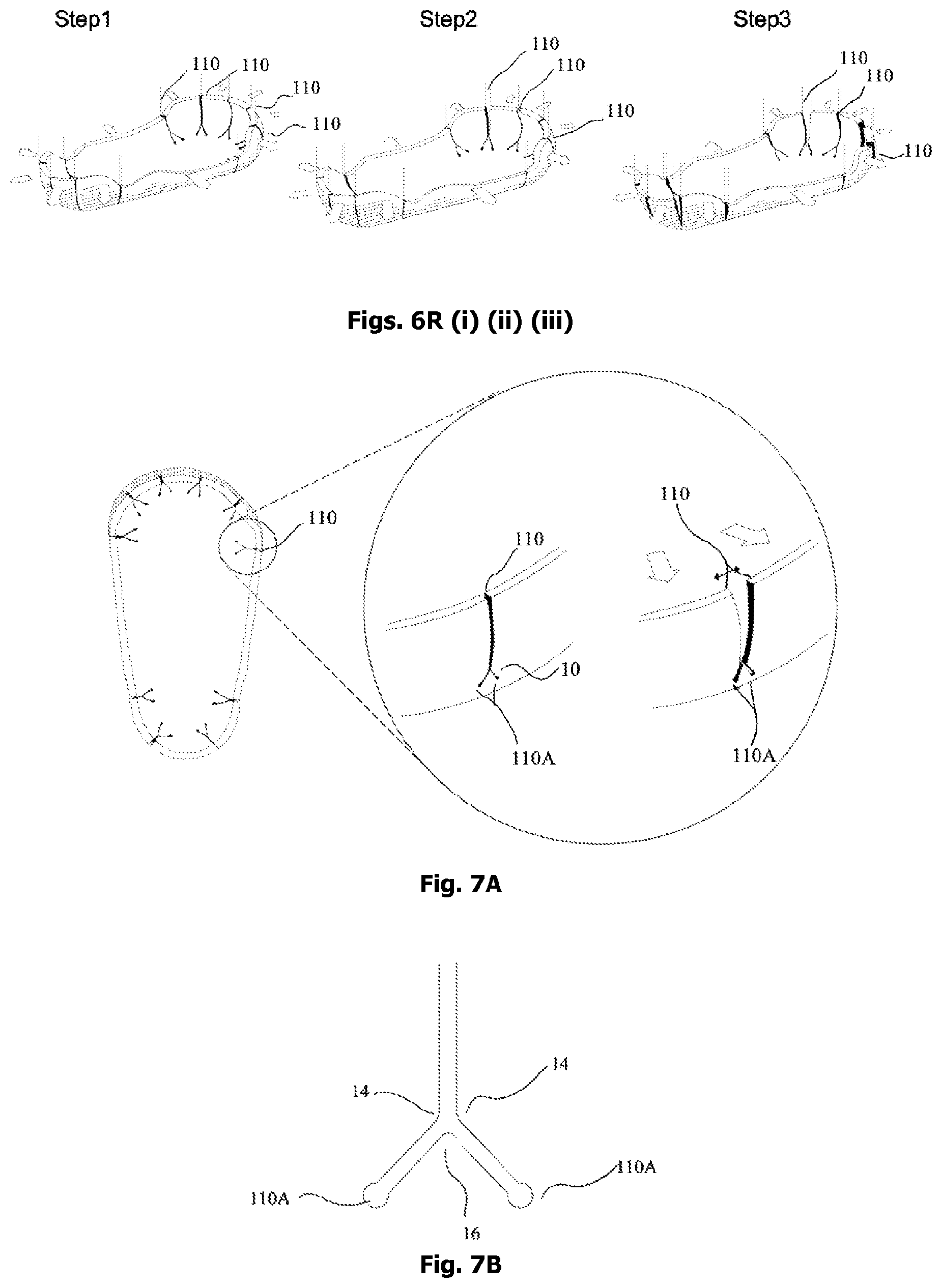 Patent US12342905 Figure 16 – Expandable shoe capable to grow with a wearer/user's feet for more than three sizes