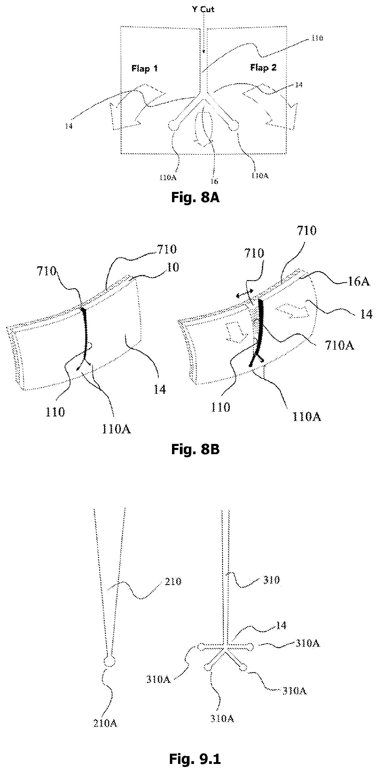 Patent US12342905 Figure 17 – Expandable shoe capable to grow with a wearer/user's feet for more than three sizes