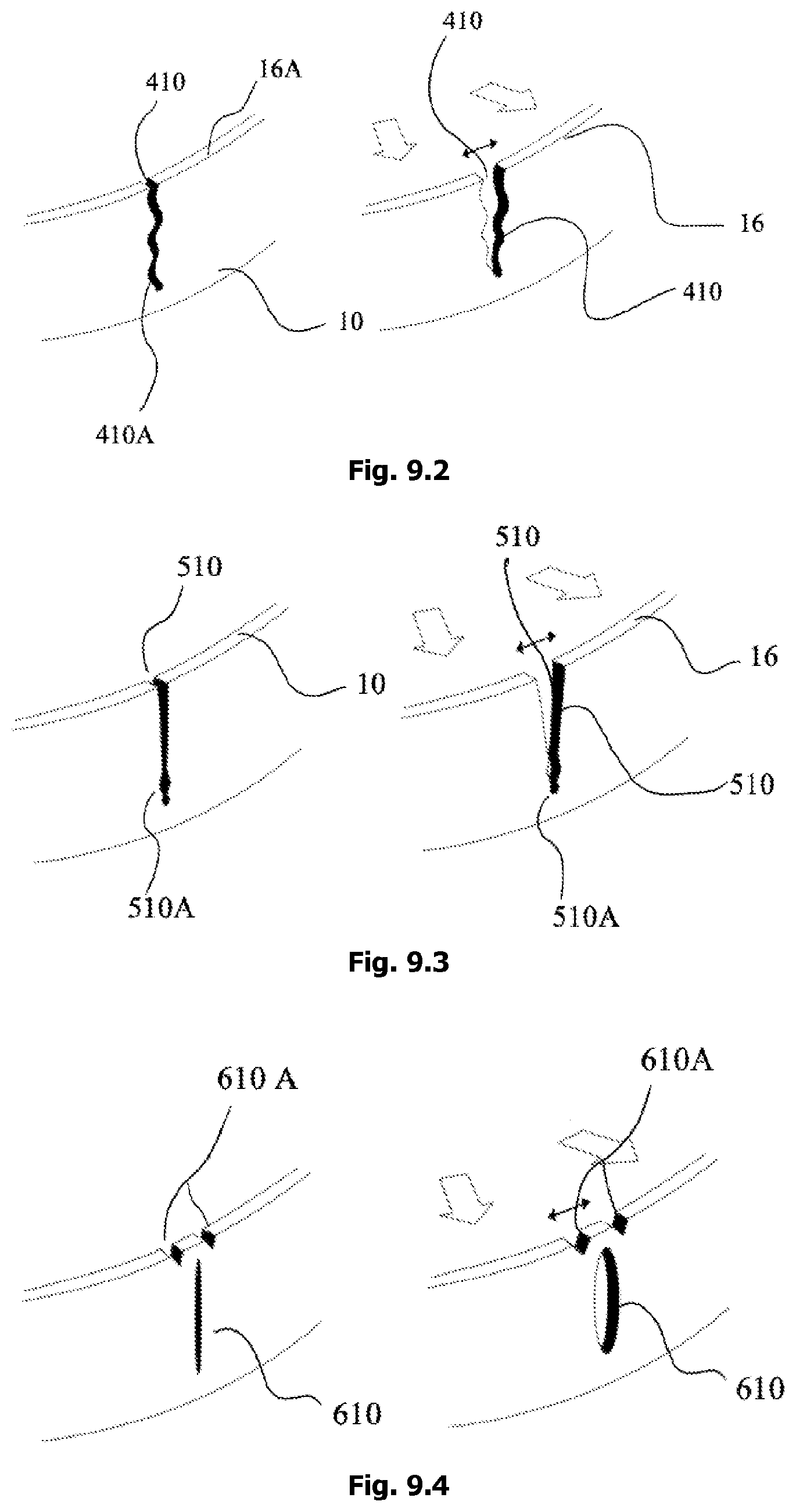Patent US12342905 Figure 18 – Expandable shoe capable to grow with a wearer/user's feet for more than three sizes