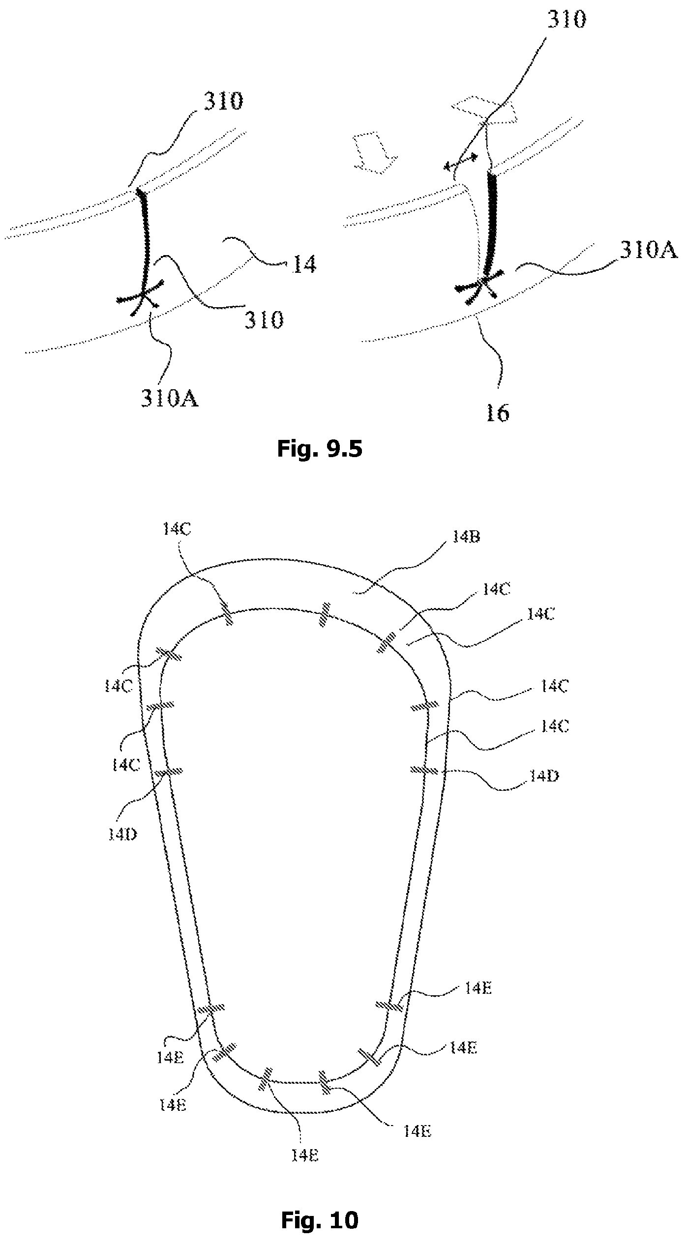 Patent US12342905 Figure 19 – Expandable shoe capable to grow with a wearer/user's feet for more than three sizes