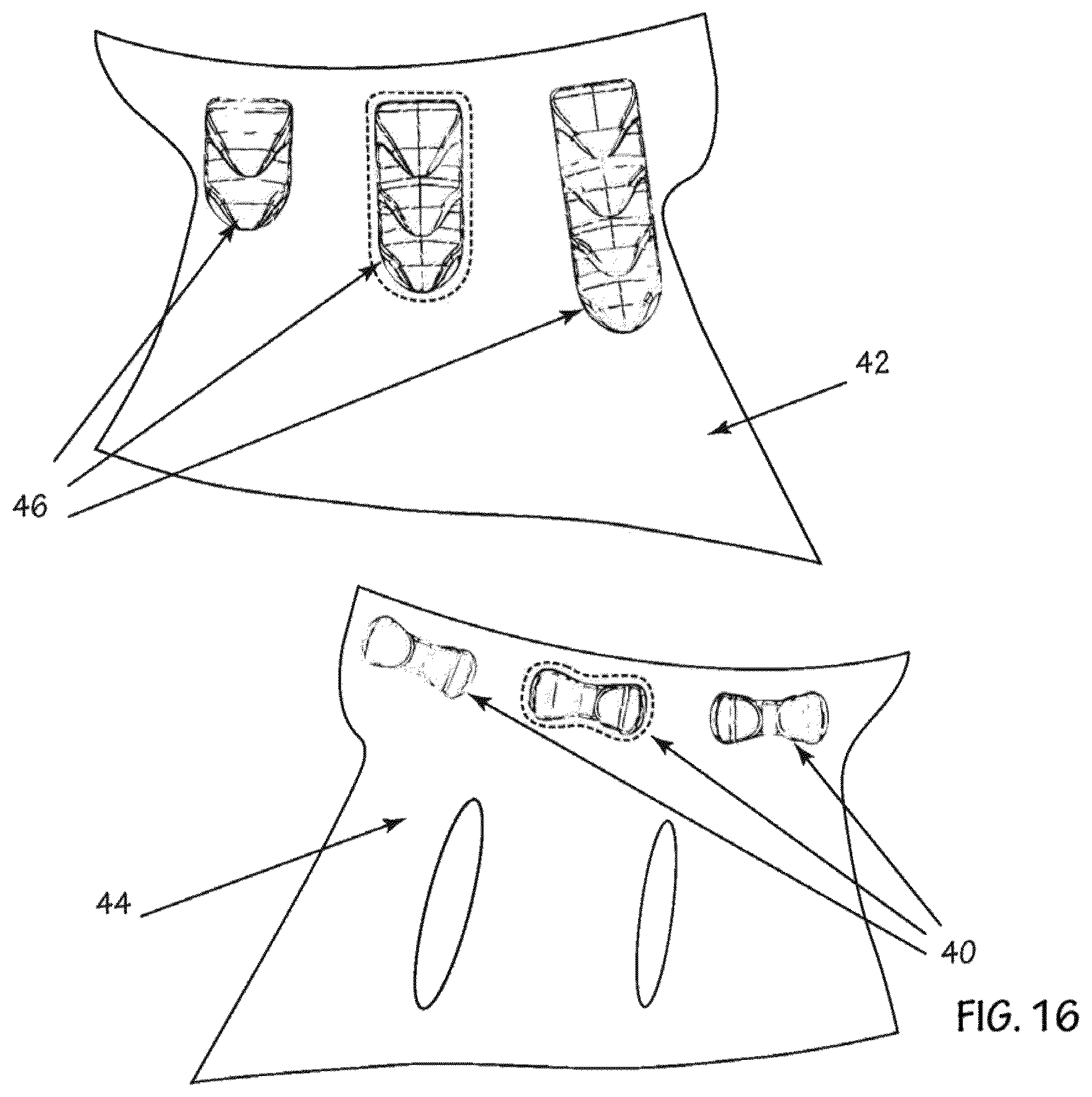 Patent US12342906 Figure 16 – Adjustable closure system for an article