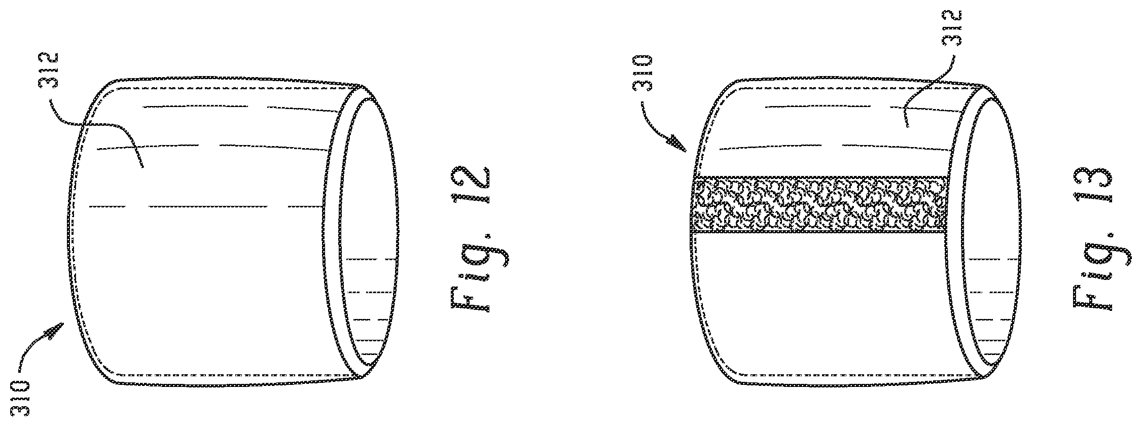 Patent US12342913 Figure 5 – Removable protective watch cover