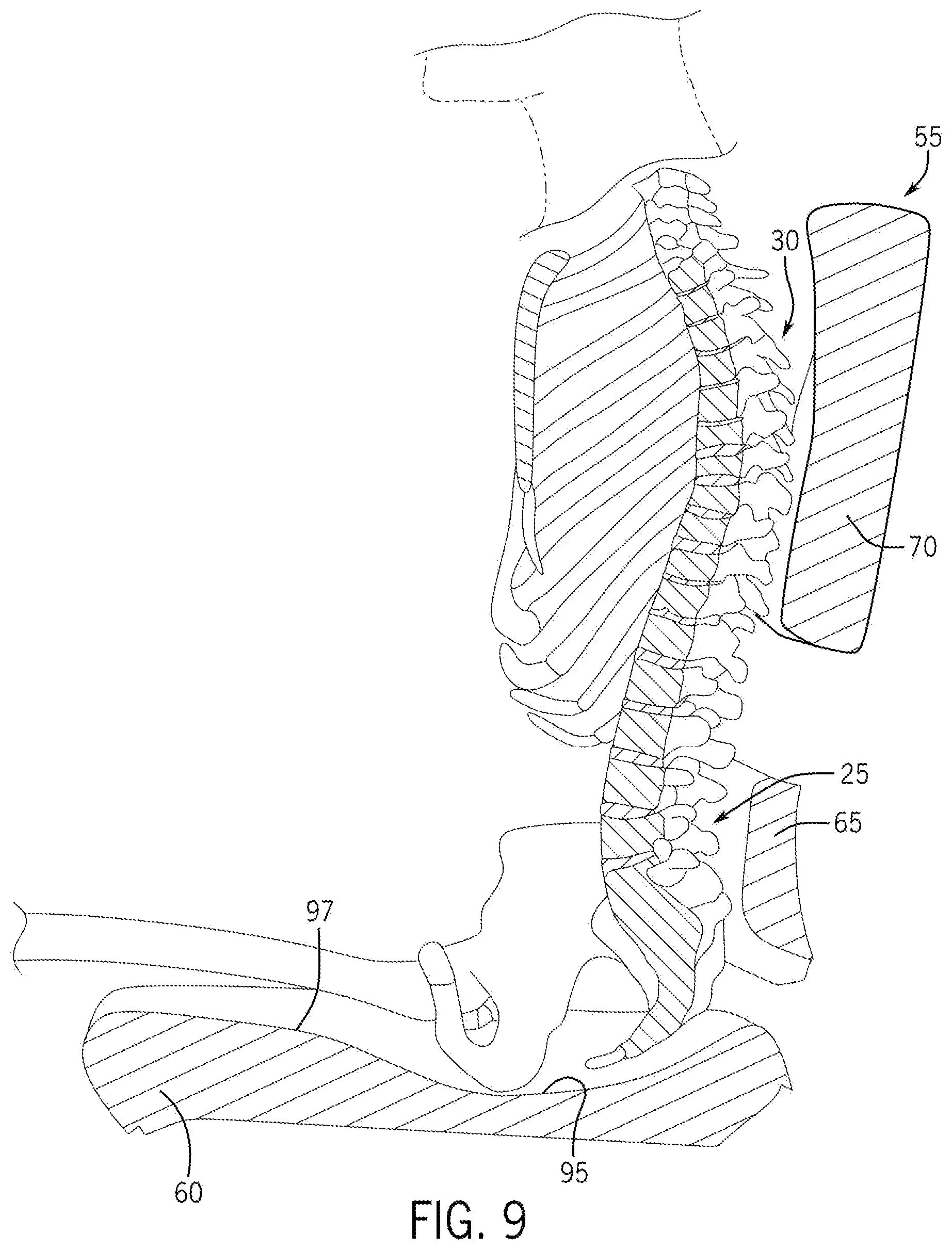 Patent US12342944 Figure 7 – Seat configuration