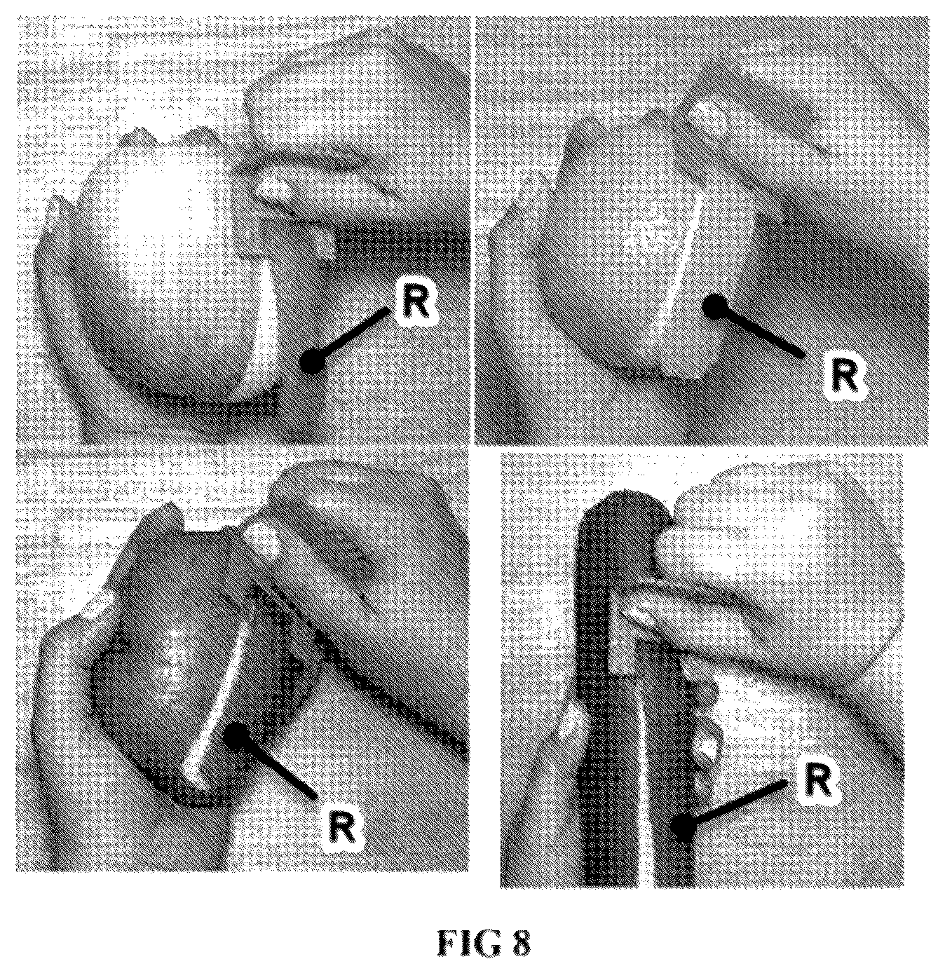 Patent US12342953 Figure 8 – Full peeler