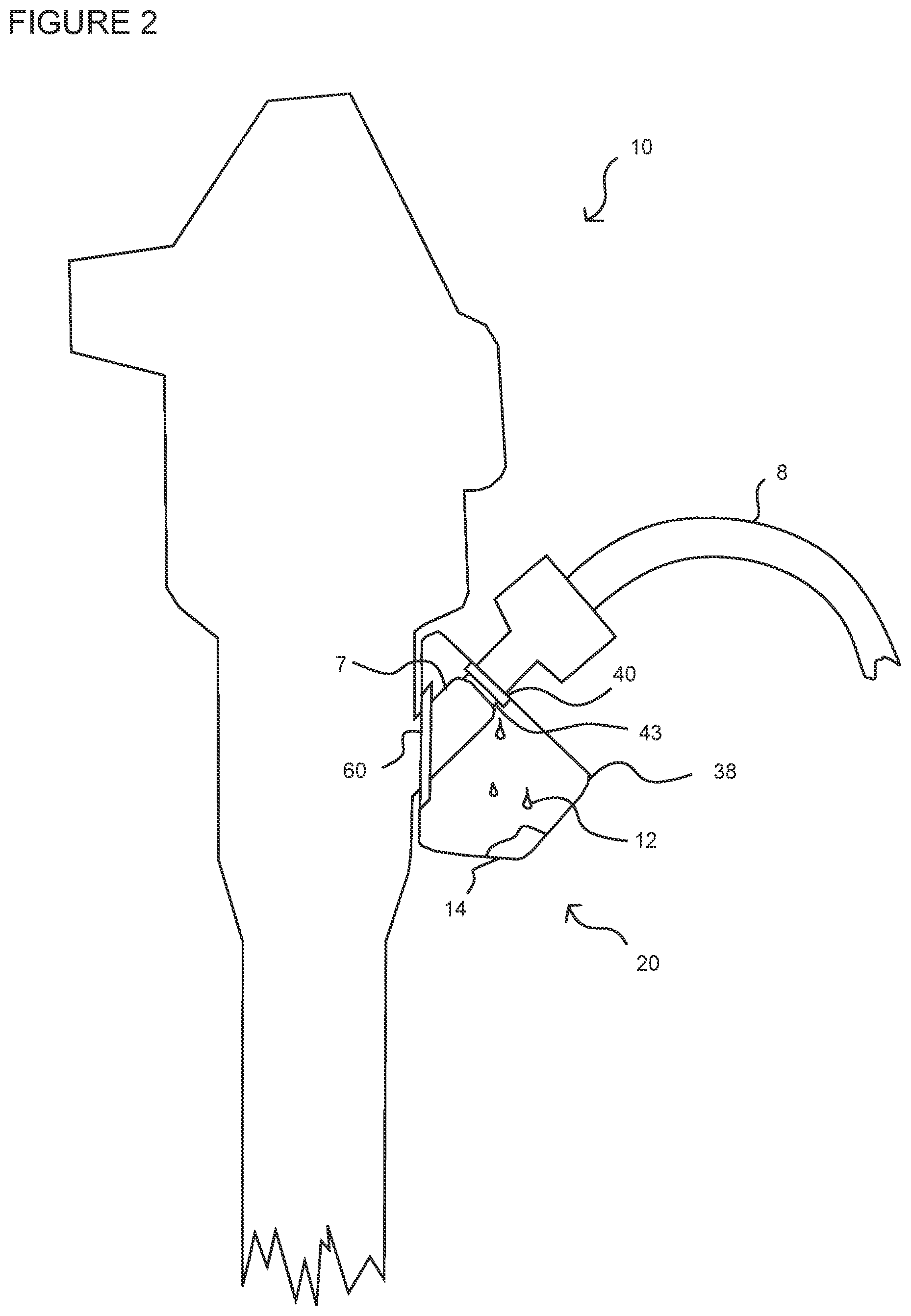 Patent US12342986 Figure 3 – Device for collection of excess fluids from an endoscope