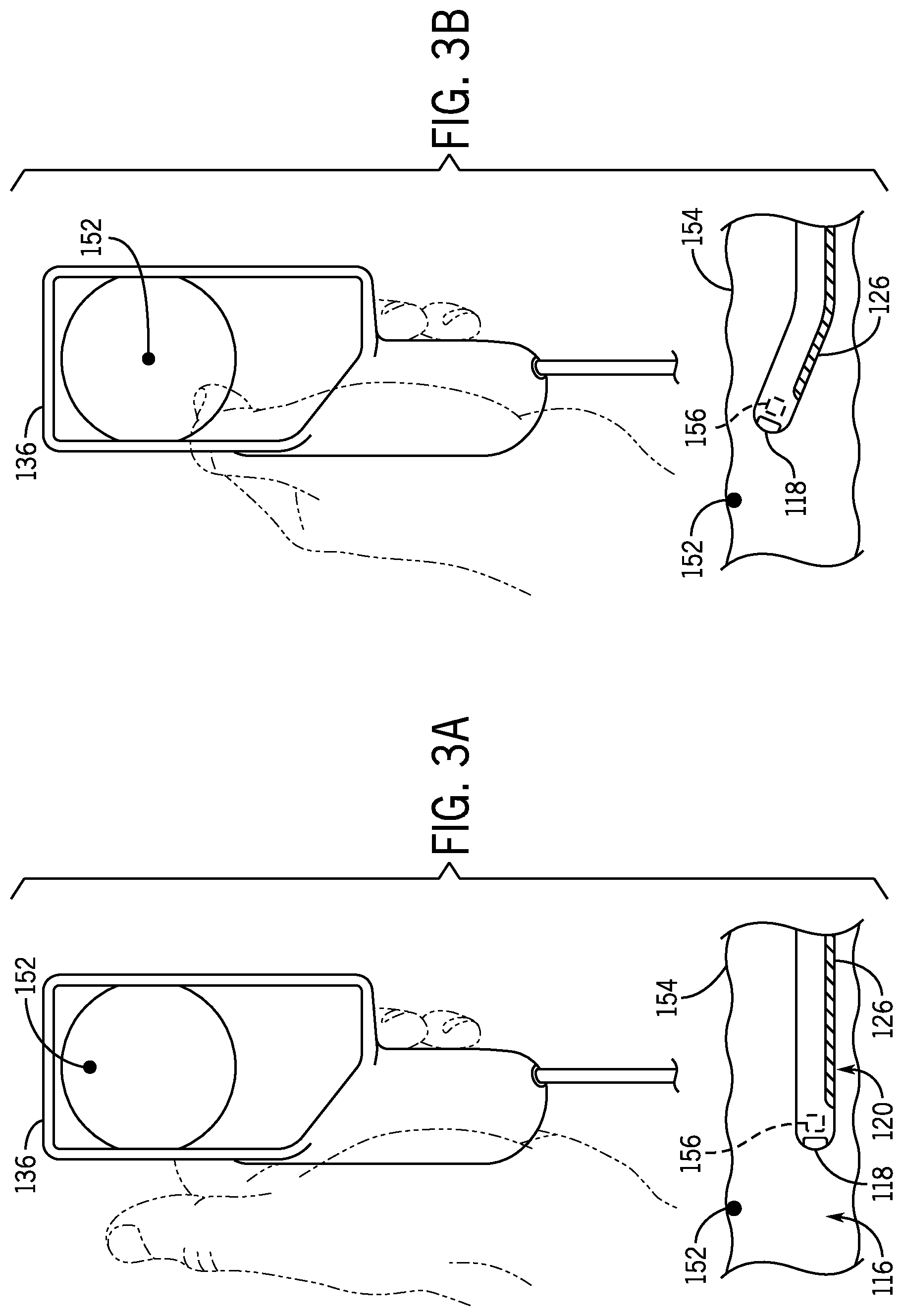 Patent US12342994 Figure 3 – Multifunctional visualization instrument with orientation control