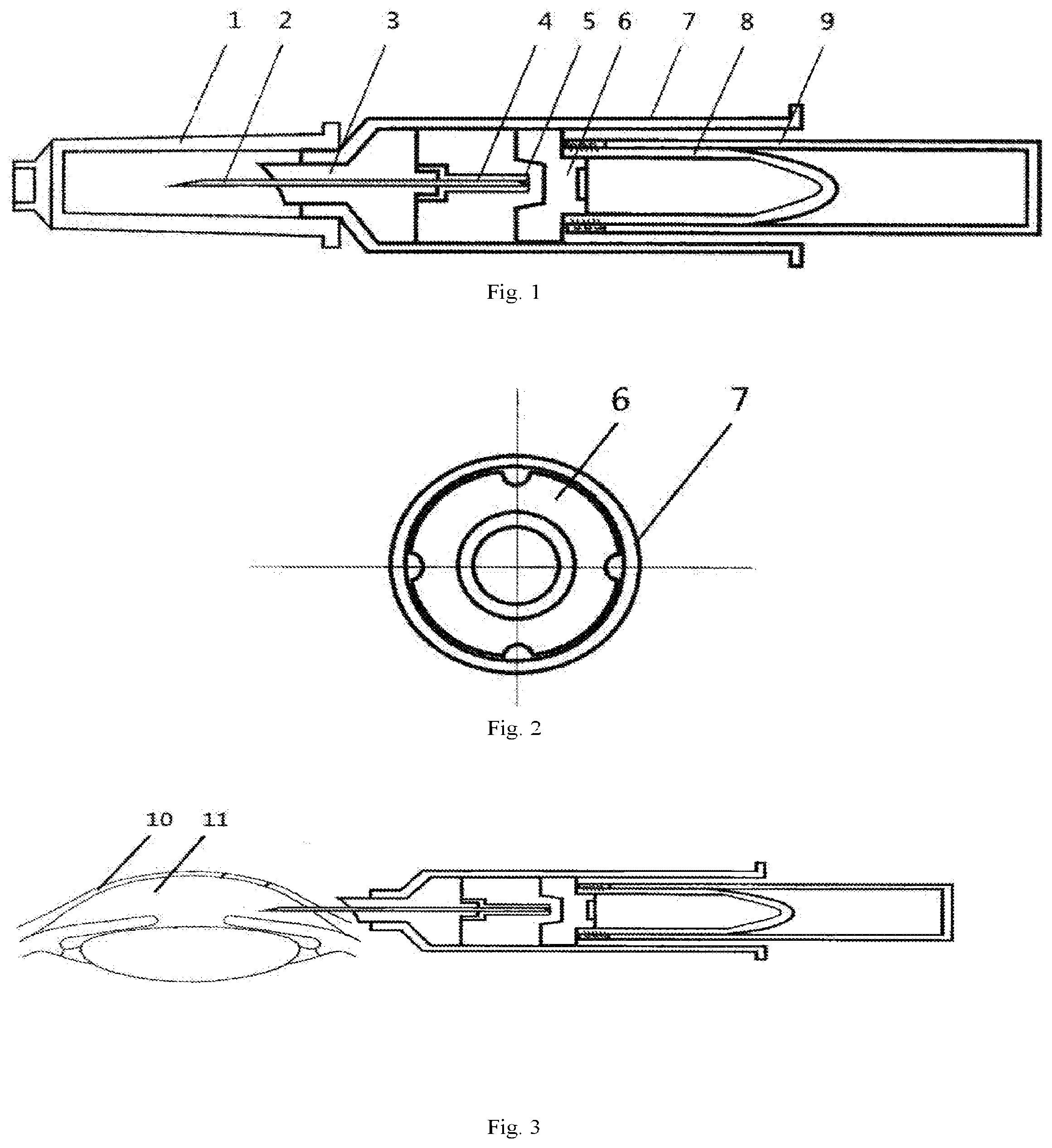 Patent US12342995 Figure 1 – Negative-pressure paracentesis syringe and use thereof