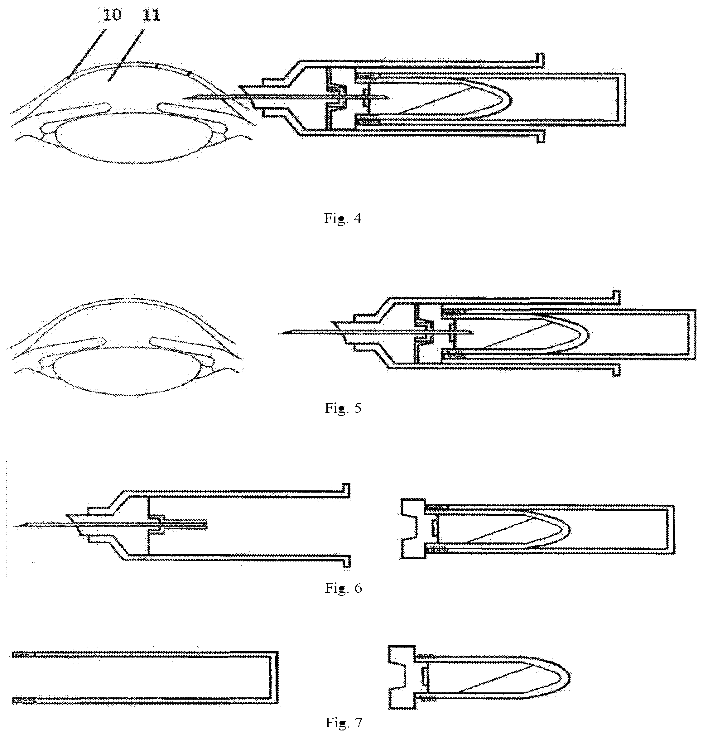 Patent US12342995 Figure 2 – Negative-pressure paracentesis syringe and use thereof