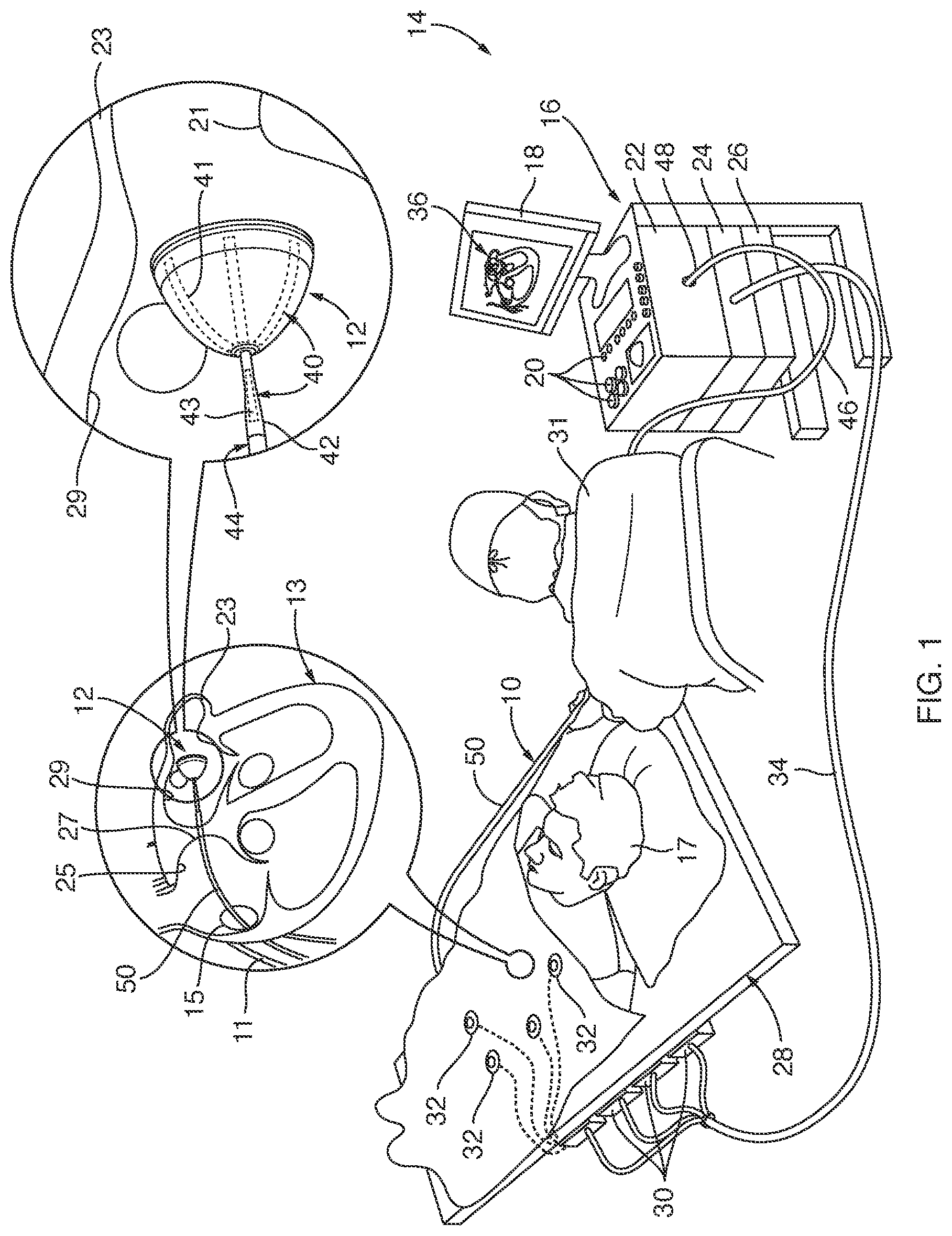 Patent US12342998 Figure 1 – Sensor enabled left atrial appendage occlusion system for three-dimensional imaging and method thereof