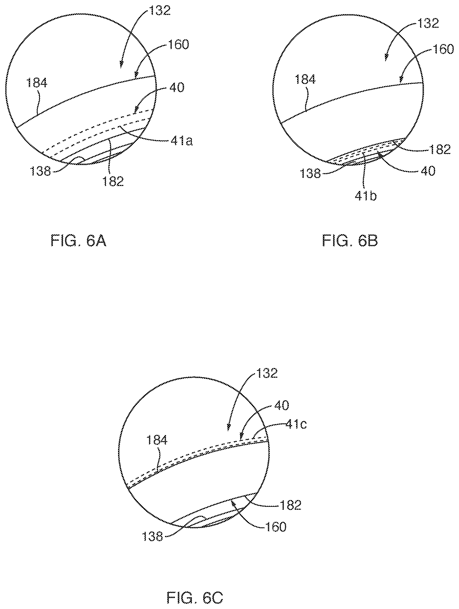 Patent US12342998 Figure 6 – Sensor enabled left atrial appendage occlusion system for three-dimensional imaging and method thereof
