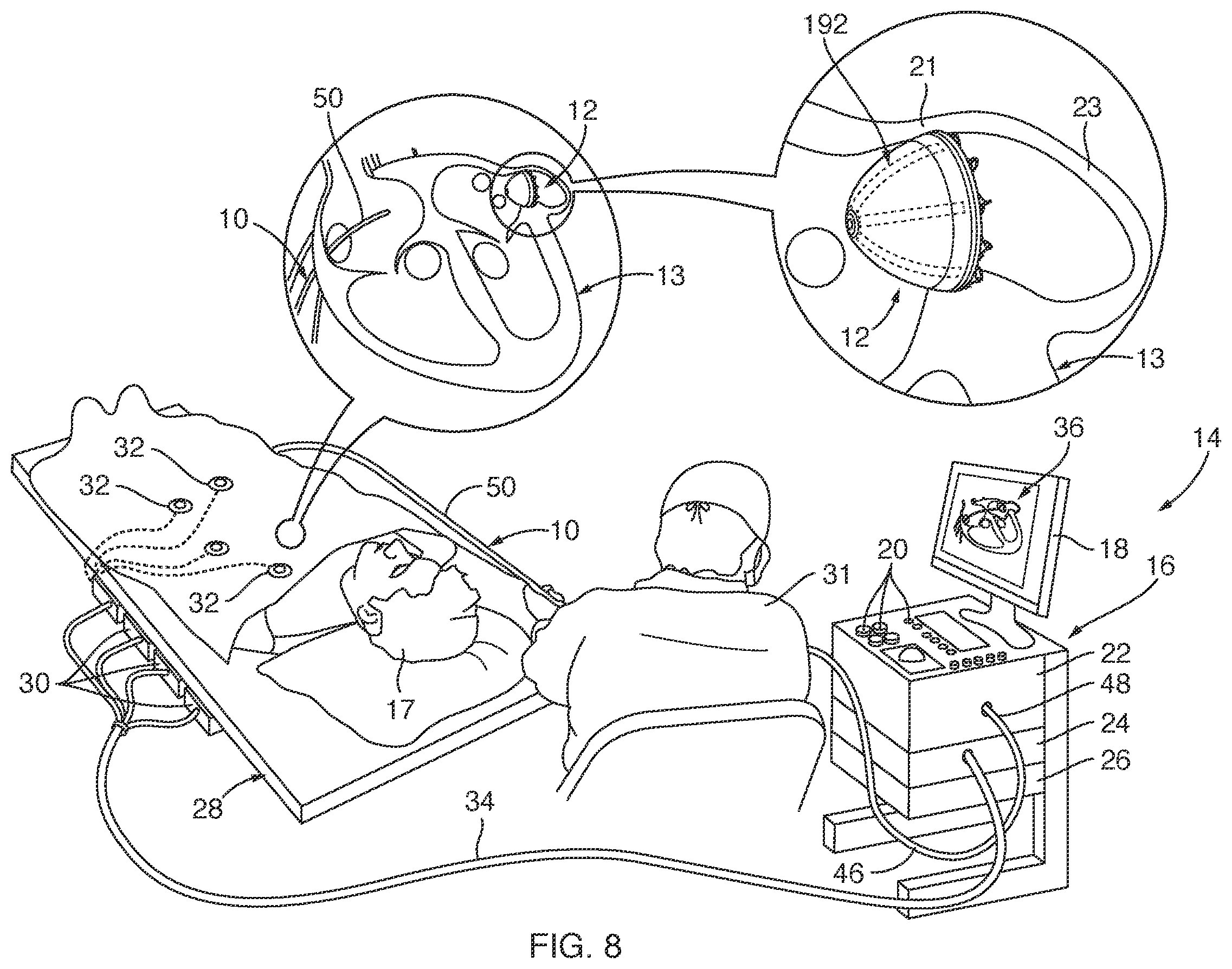Patent US12342998 Figure 8 – Sensor enabled left atrial appendage occlusion system for three-dimensional imaging and method thereof