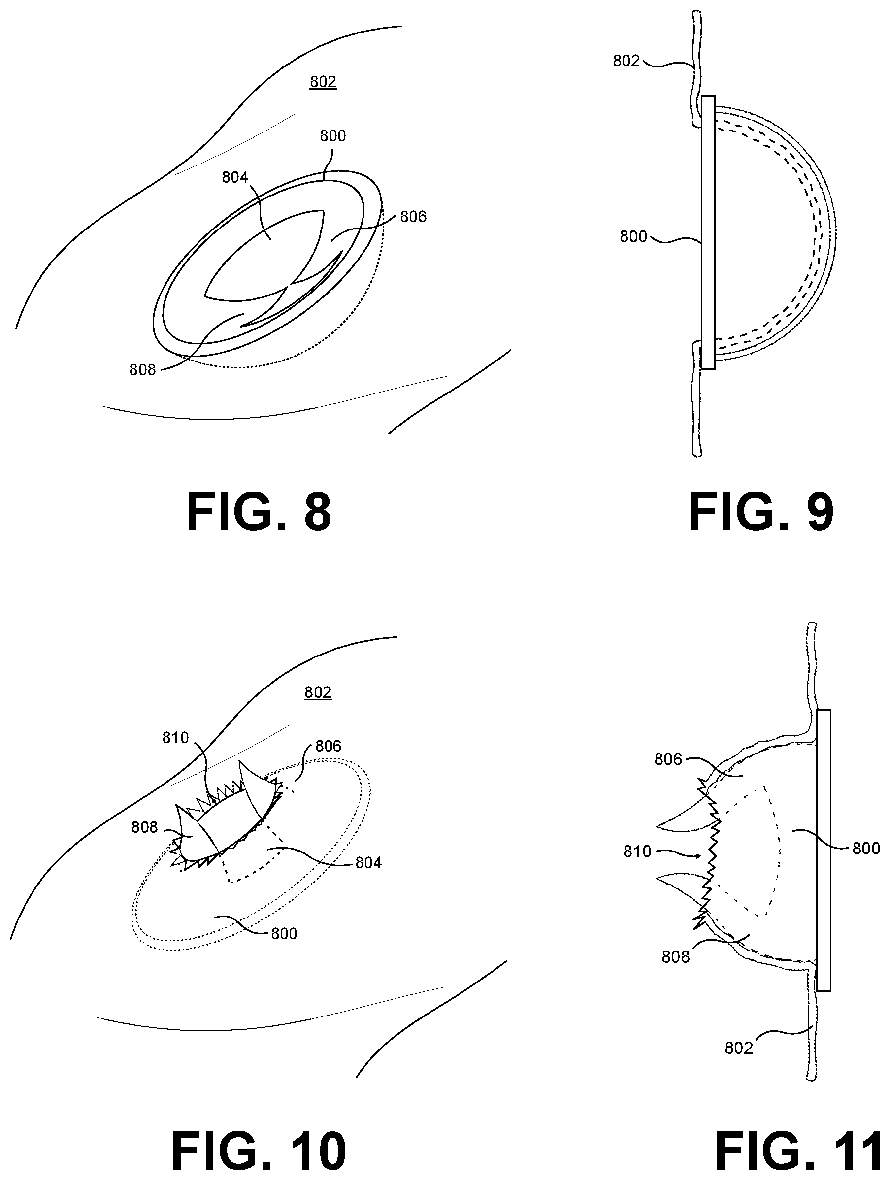Patent US12345027 Figure 4 – Thermally activated warmer