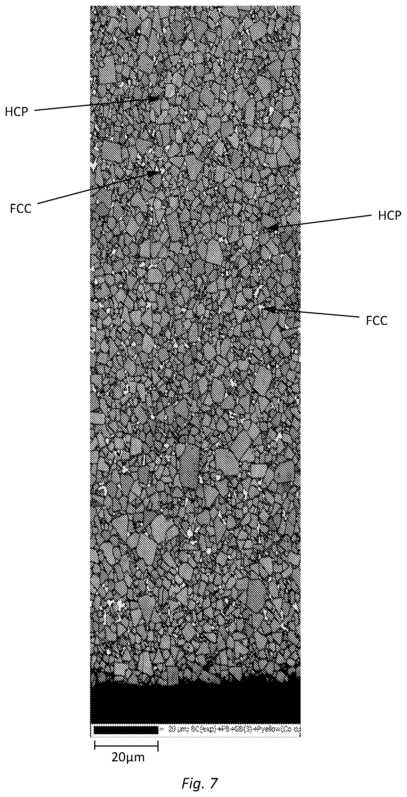Patent US12345097 Figure 5 – Rock drill insert and method for manufacturing a rock drill insert