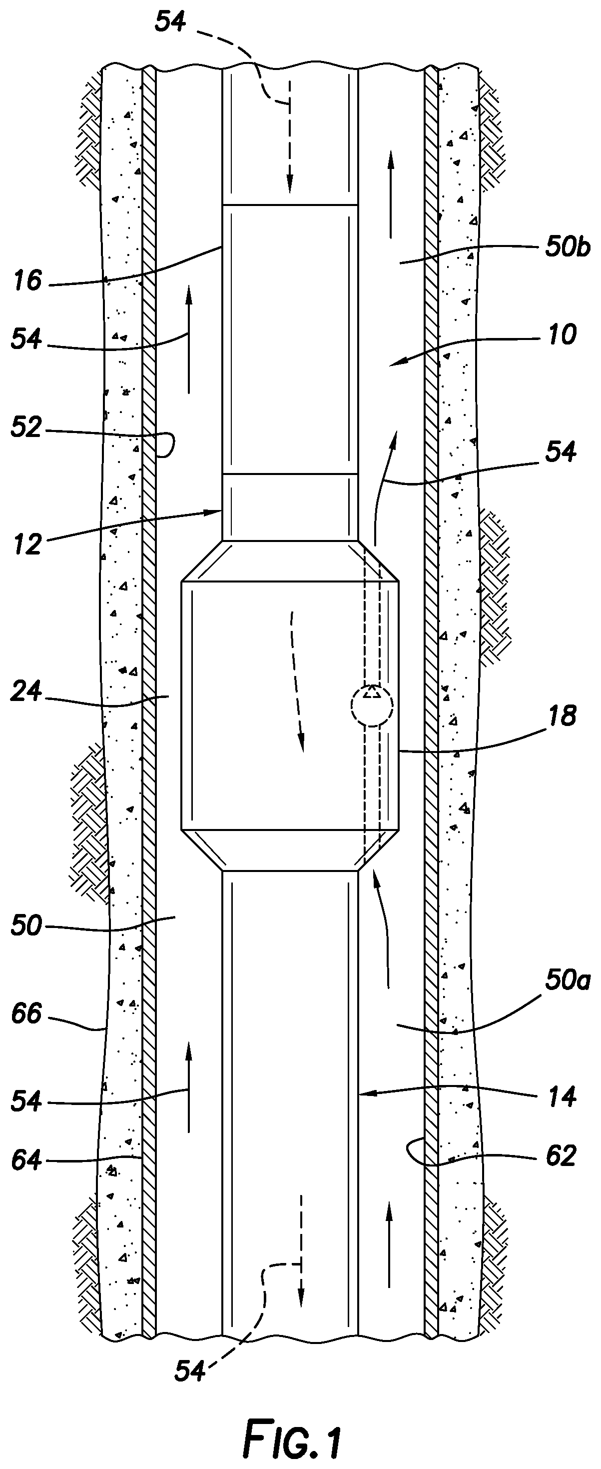 Patent US12345107 — Reduction of equivalent circulating density in well operations — Figure 1