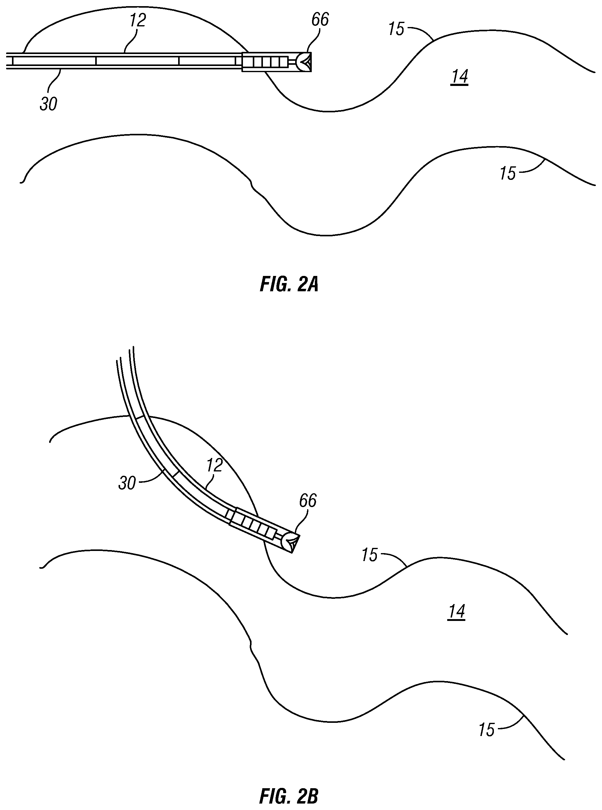 Patent US12345148 Figure 2 – Systems and methods for characterizing a subterranean formation having a formation boundary surface