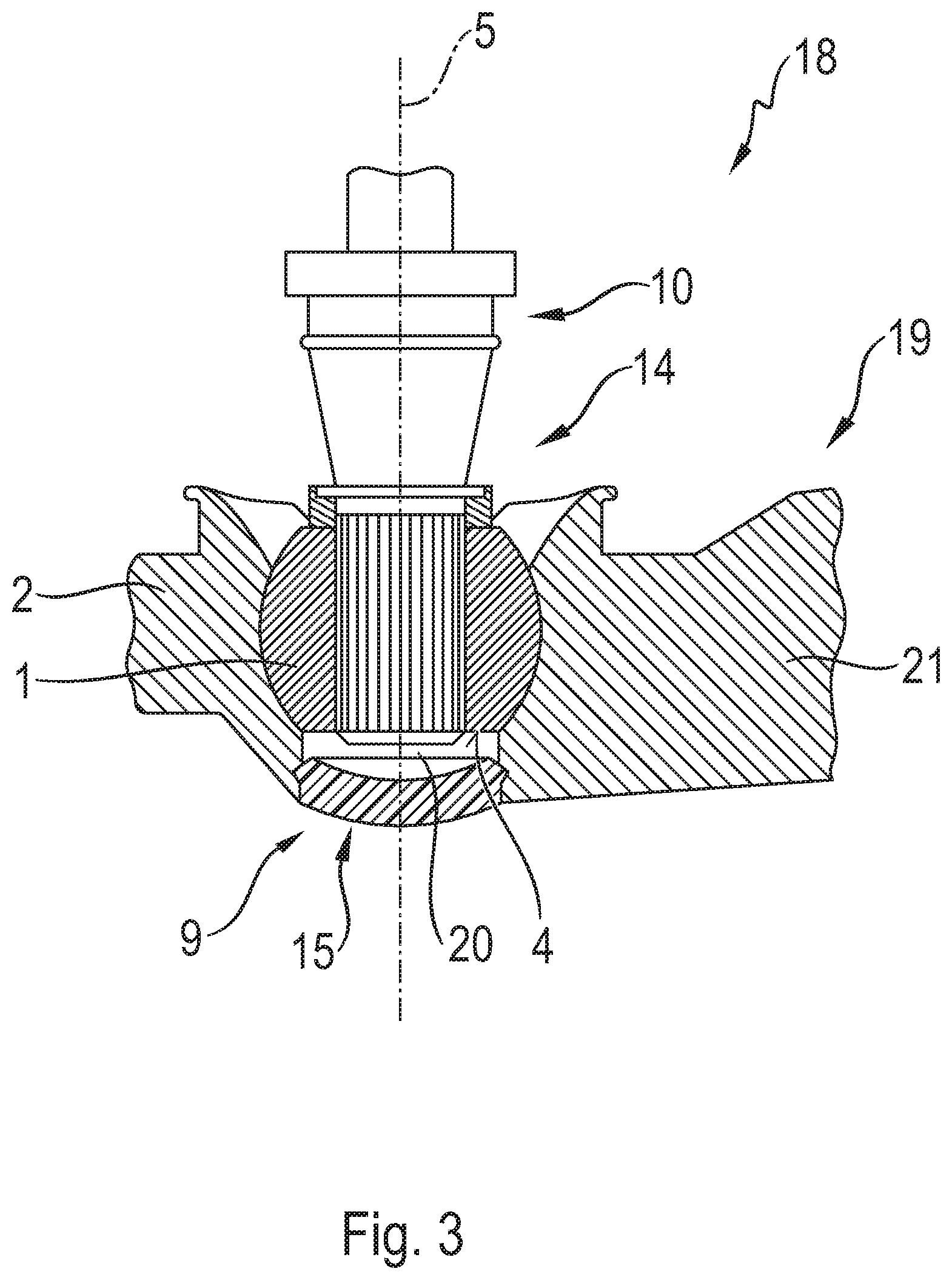 Patent US12345290 Figure 3 – Method for producing a ball joint and/or a chassis component, and chassis component of this type