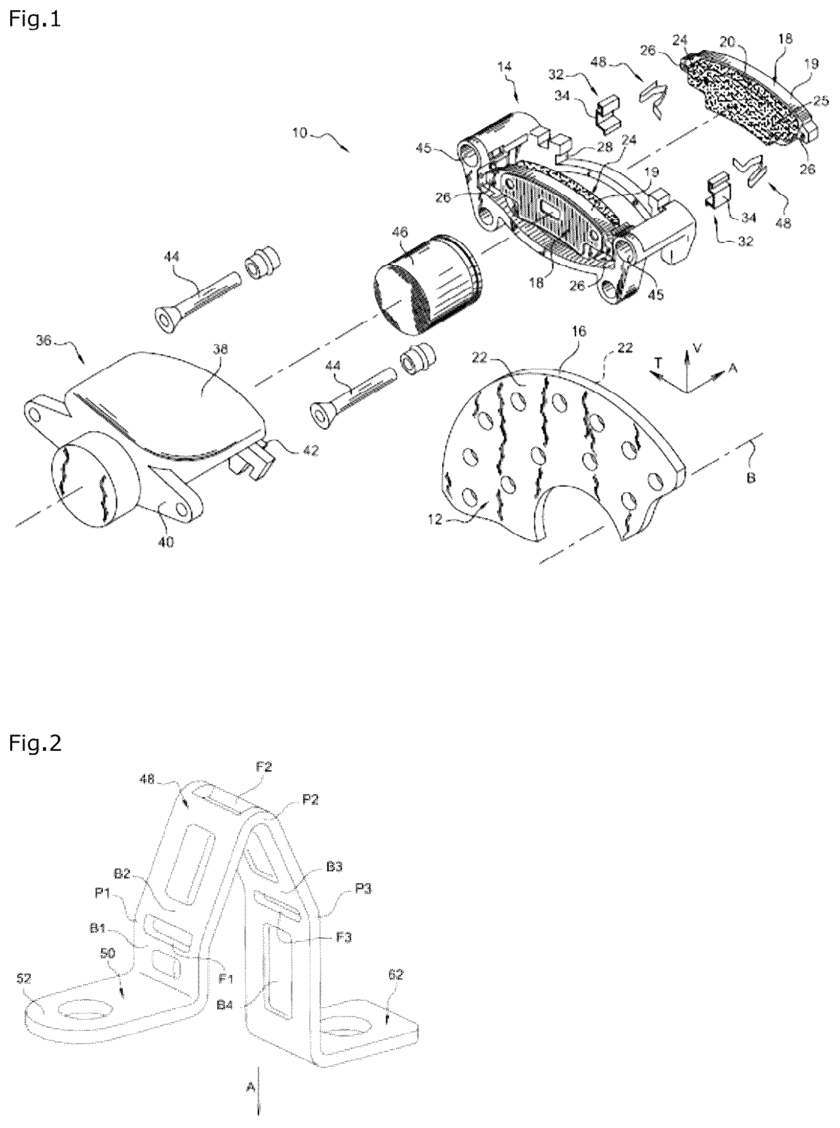 Patent US12345305 Figure 1 – Disc brake comprising at least one elastic return spring for a brake pad, elastic return spring, replacement kit and mounting method