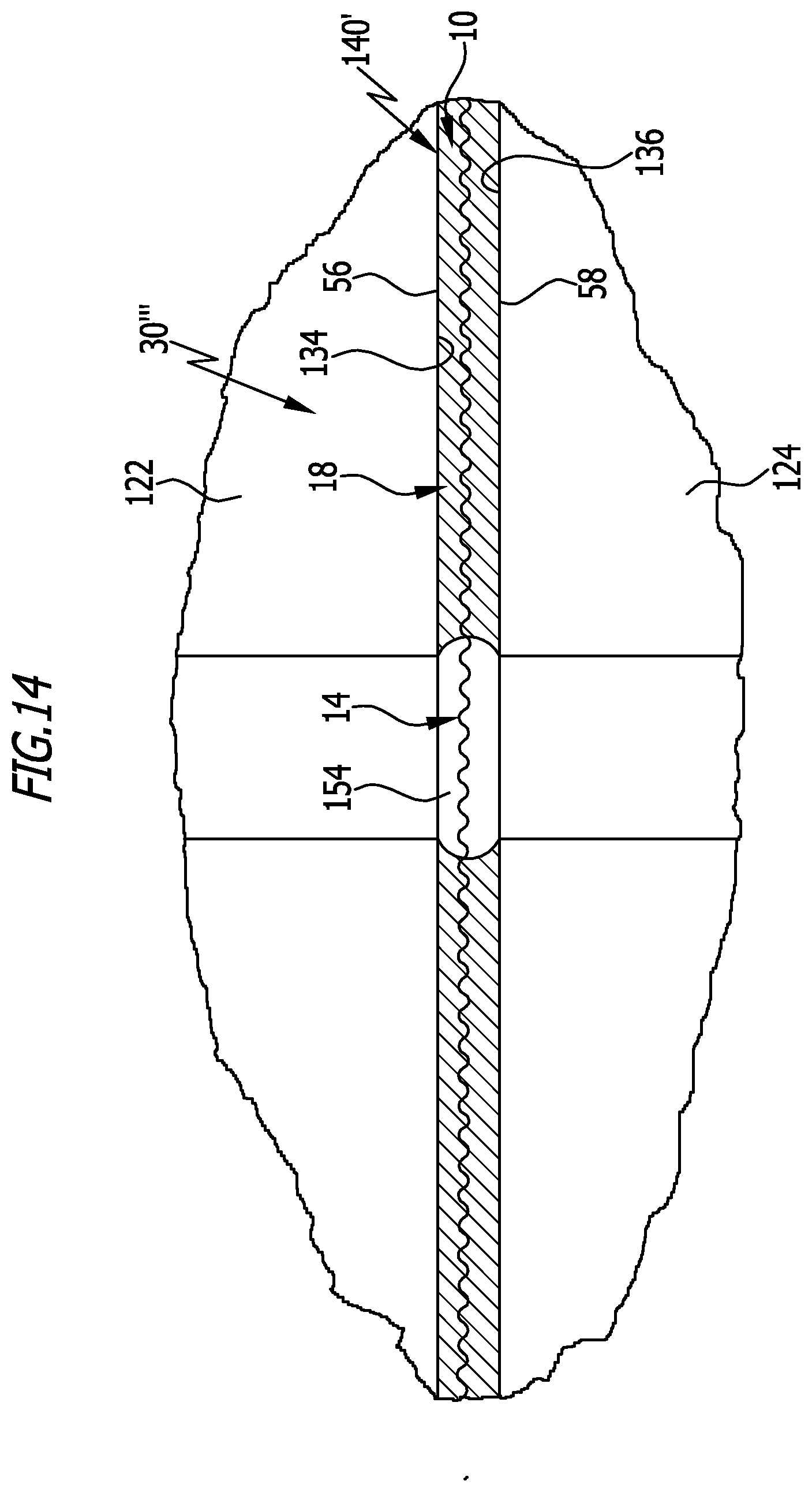 Patent US12345333 Figure 14 – Method for producing a functional element for flat seals and functional element for flat seals