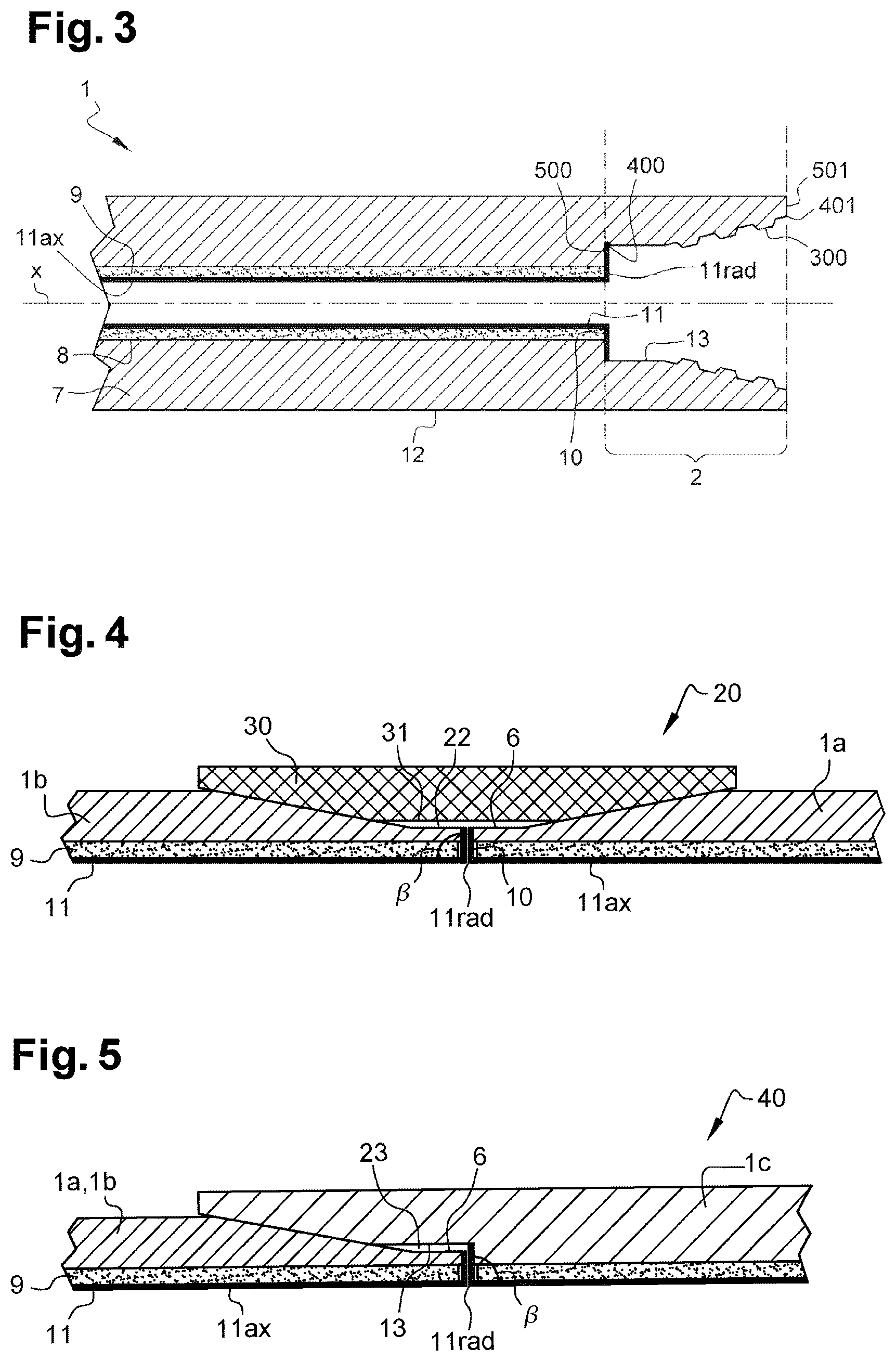 Patent US12345368 Figure 2 – Metal tubular component, tubular threaded joint comprising such a component and method of obtaining such a component