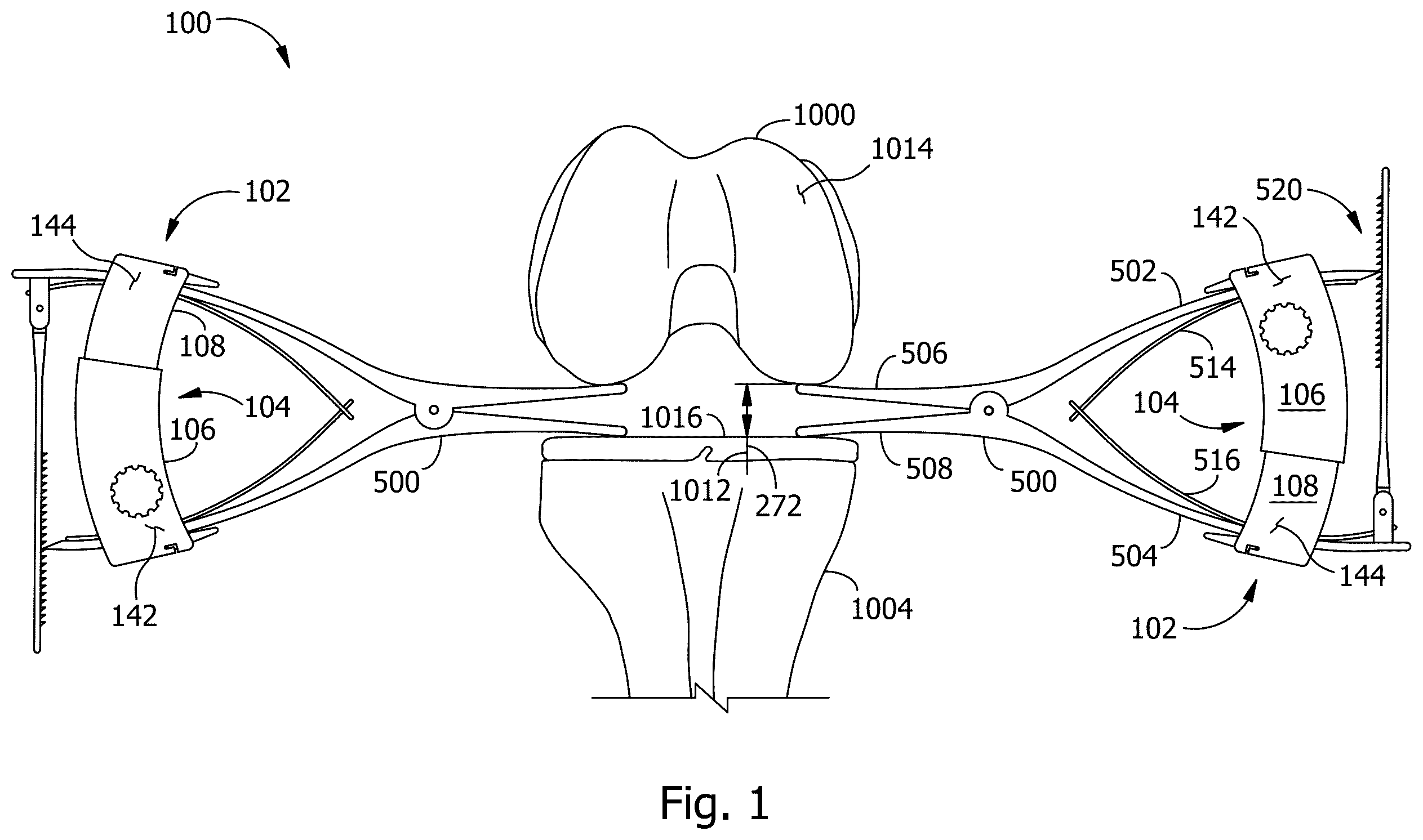 Patent US12345590 Figure 1 – Measurement instrument for measuring force and displacement data from a surgical spreader