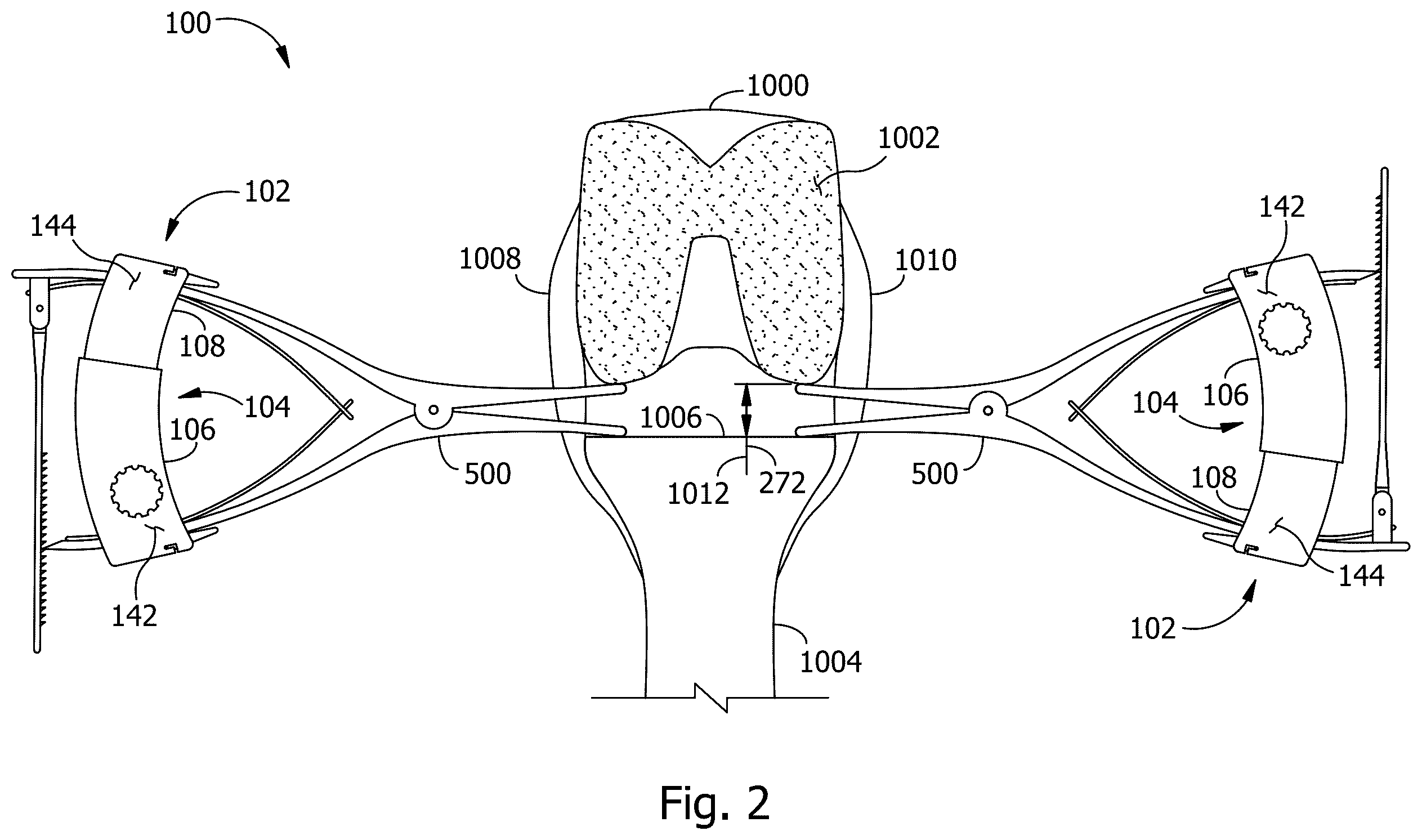 Patent US12345590 Figure 2 – Measurement instrument for measuring force and displacement data from a surgical spreader