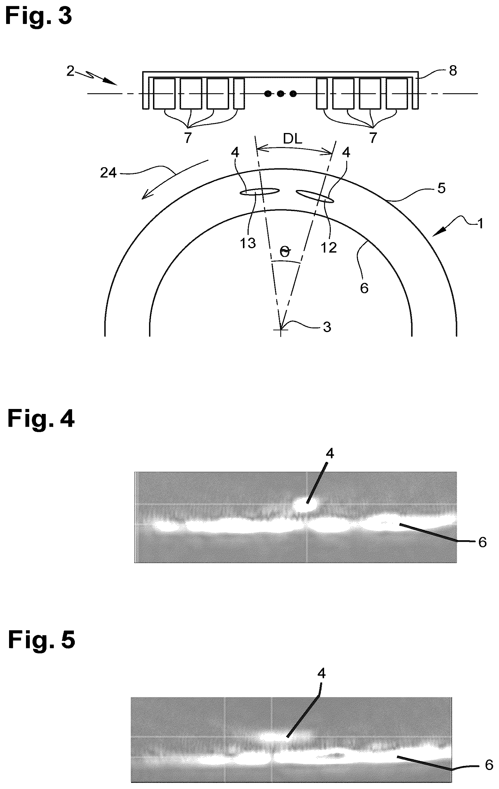 Patent US12345685 Figure 2 – Method for dynamic testing using ultrasonic imaging