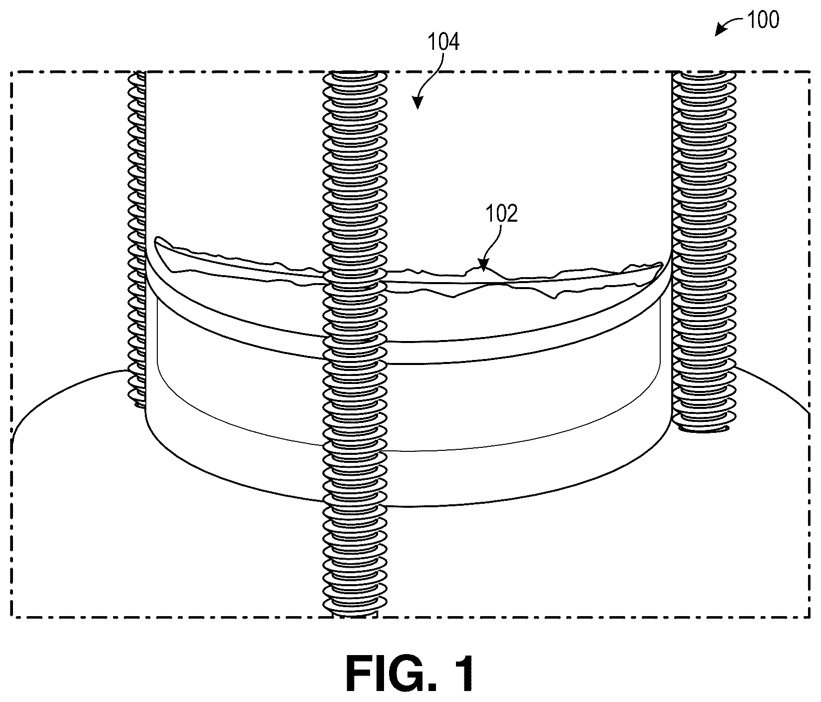 Patent US12345688 Figure 1 – Dynamic axial compression for preparative columns using external compression