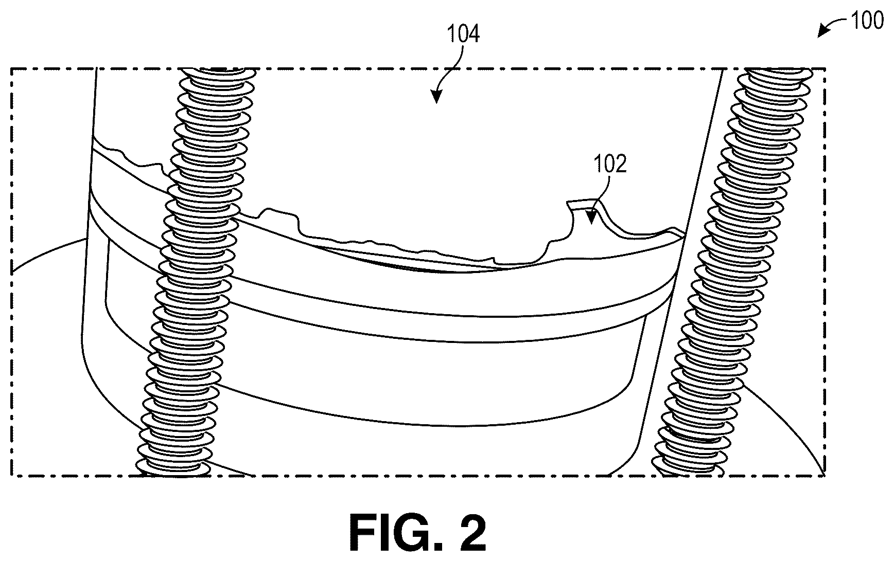 Patent US12345688 Figure 2 – Dynamic axial compression for preparative columns using external compression