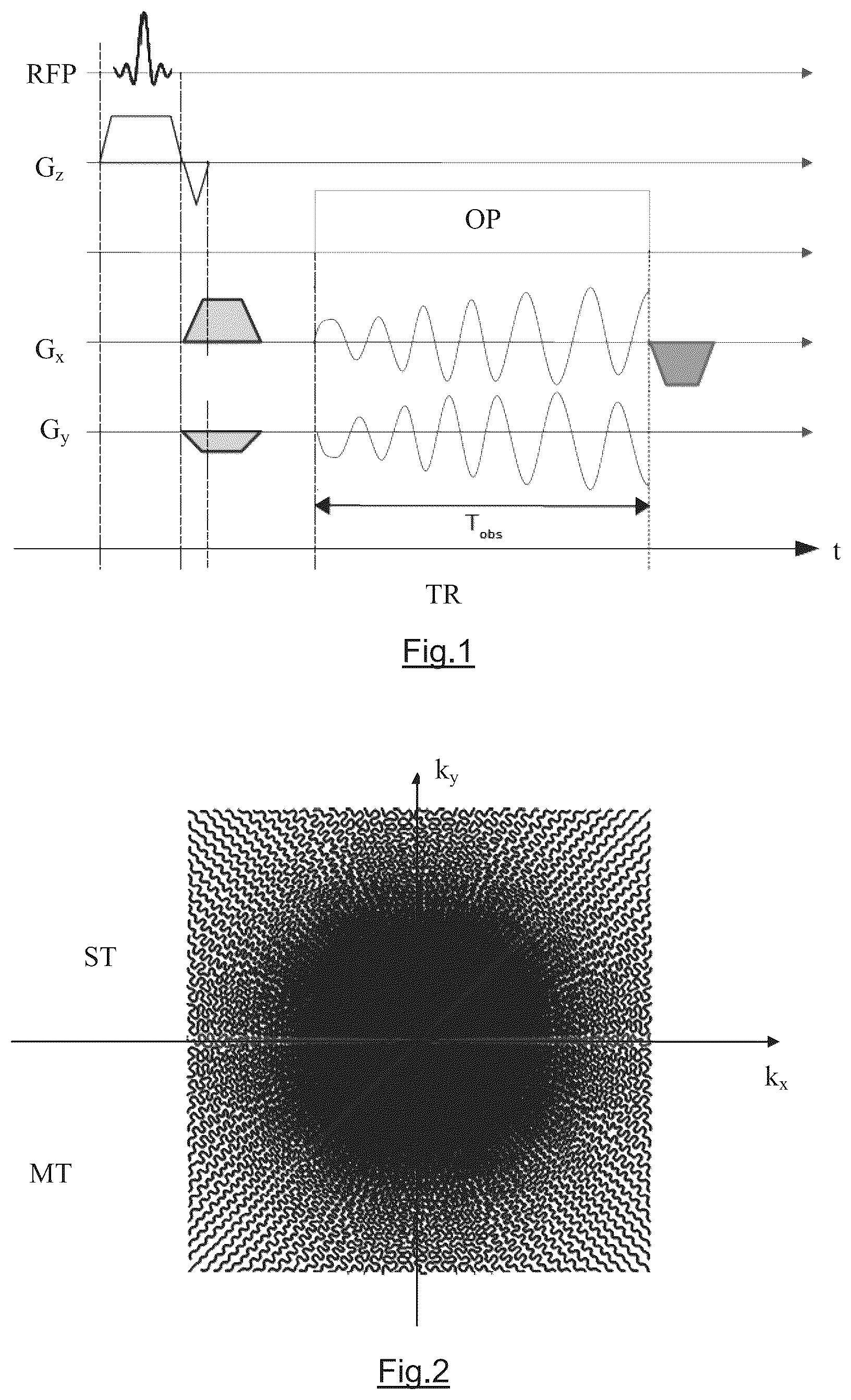 Patent US12345785 Figure 1 – Method and apparatus for performing accelarated magnetic resonance imaging with reduced off-resonance effect