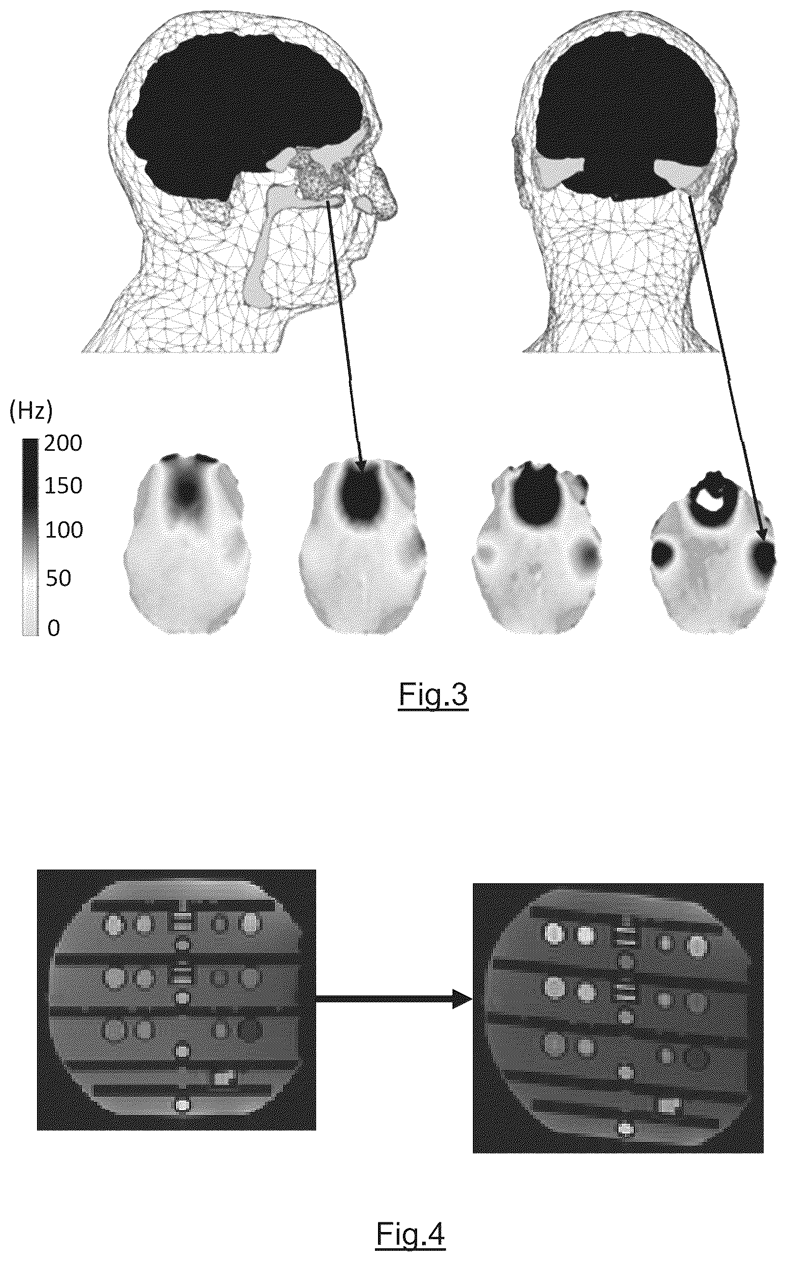 Patent US12345785 Figure 2 – Method and apparatus for performing accelarated magnetic resonance imaging with reduced off-resonance effect