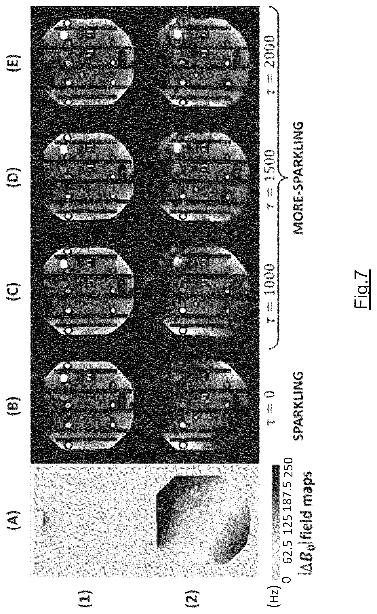 Patent US12345785 Figure 4 – Method and apparatus for performing accelarated magnetic resonance imaging with reduced off-resonance effect