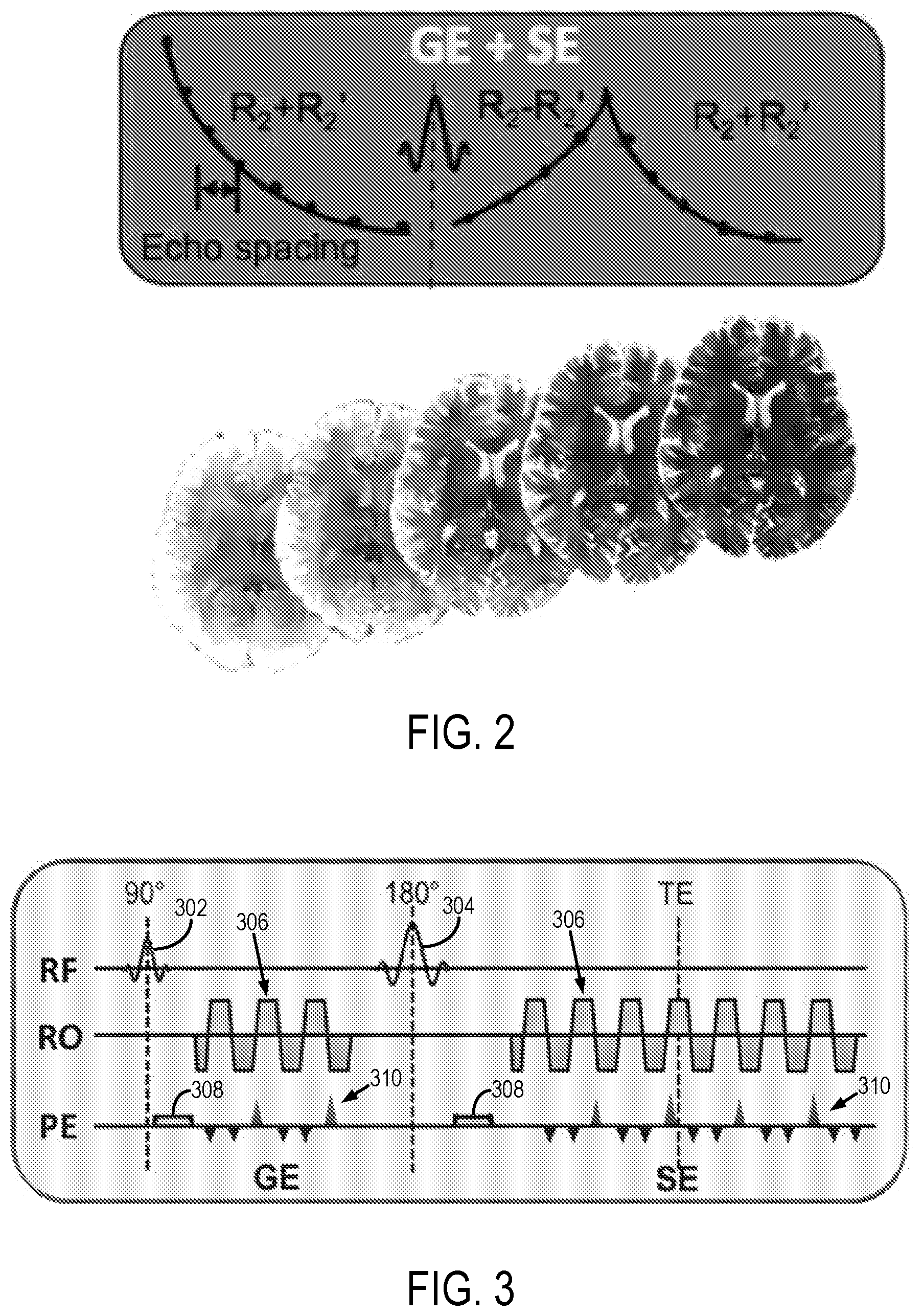 Patent US12345786 Figure 2 – Propeller echo planar time-resolved imaging with dynamic encoding