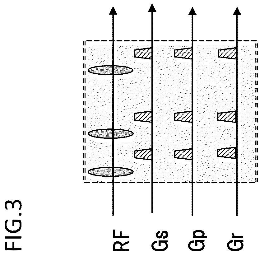 Patent US12345787 Figure 3 – Magnetic resonance imaging apparatus and control method thereof