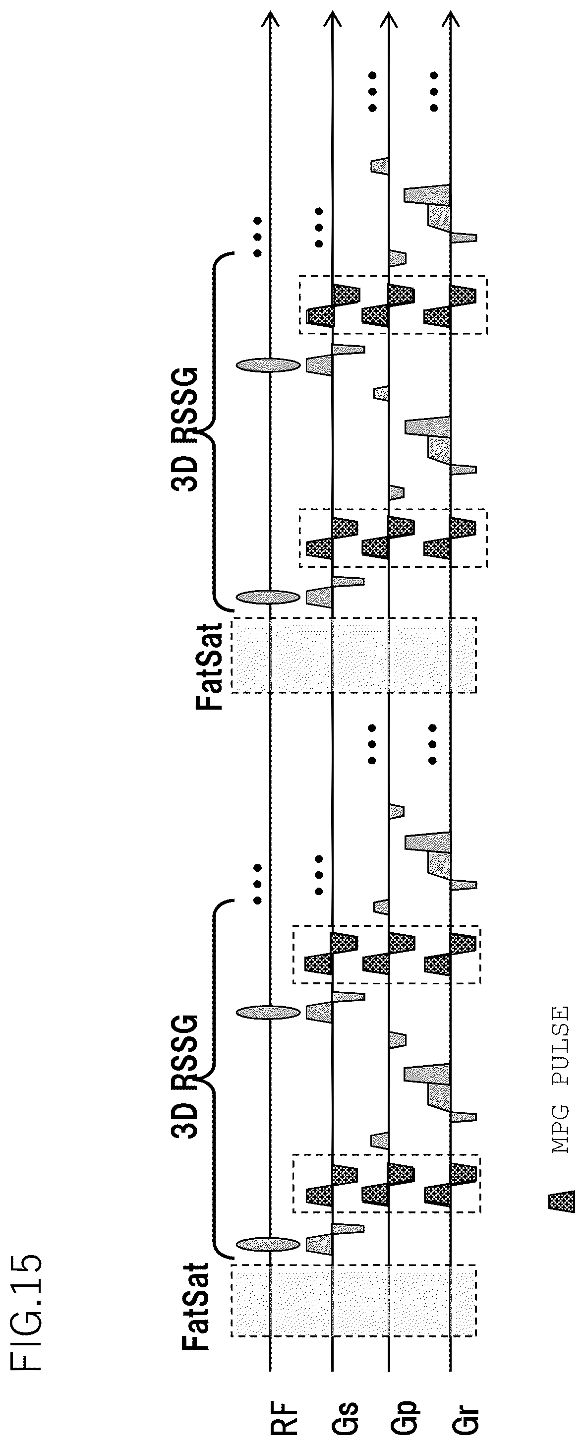 Patent US12345787 Figure 15 – Magnetic resonance imaging apparatus and control method thereof