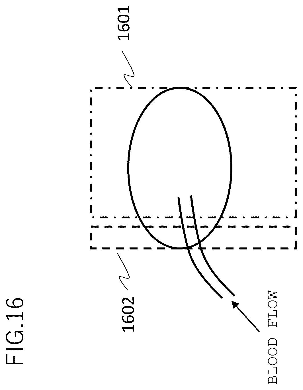 Patent US12345787 Figure 16 – Magnetic resonance imaging apparatus and control method thereof