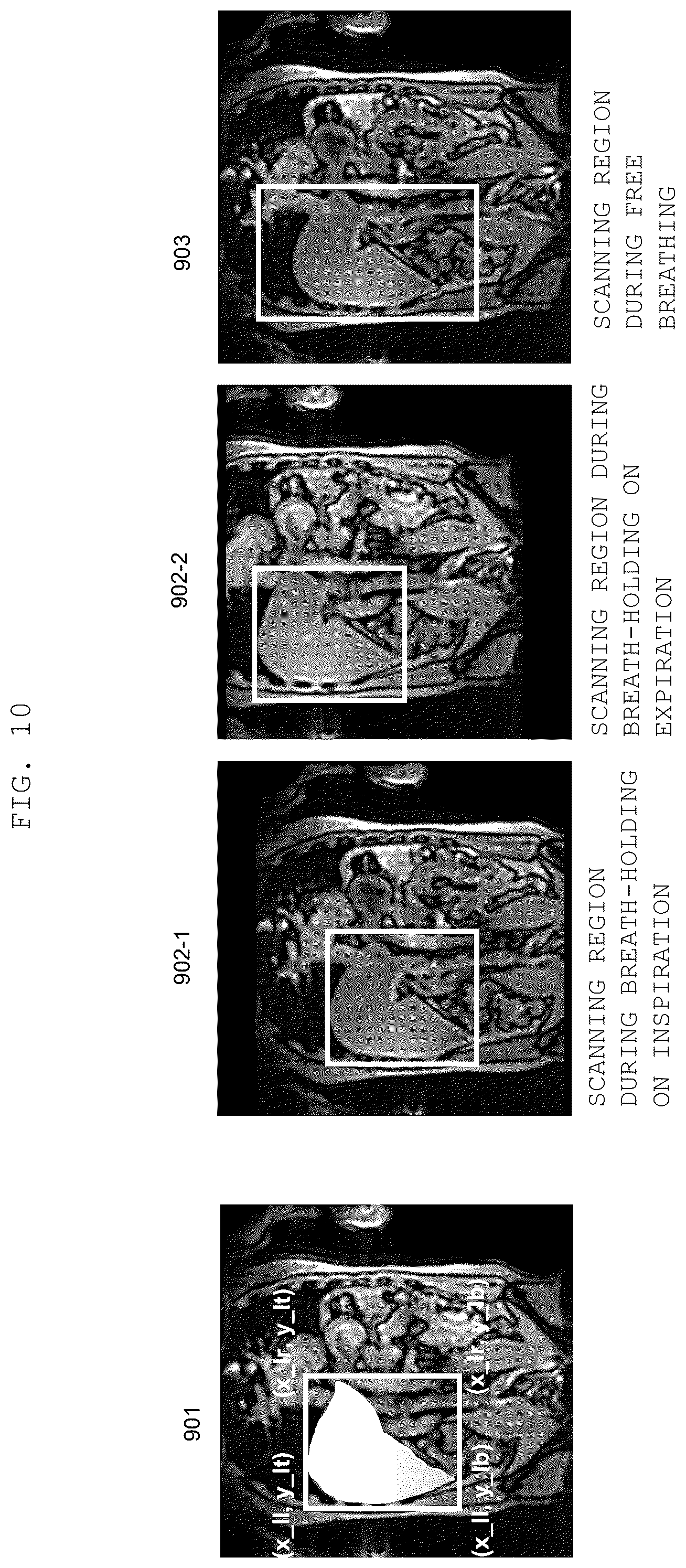 Patent US12345790 Figure 10 – Magnetic resonance imaging apparatus and imaging position determination method