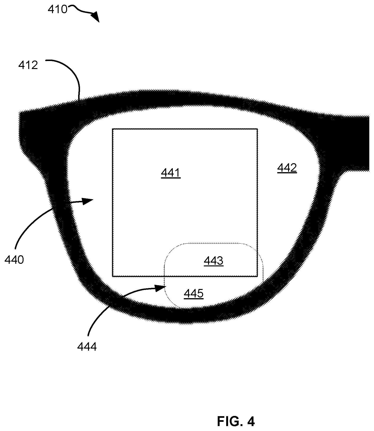 Patent US12345885 Figure 4 – Optical lens set and image combiner