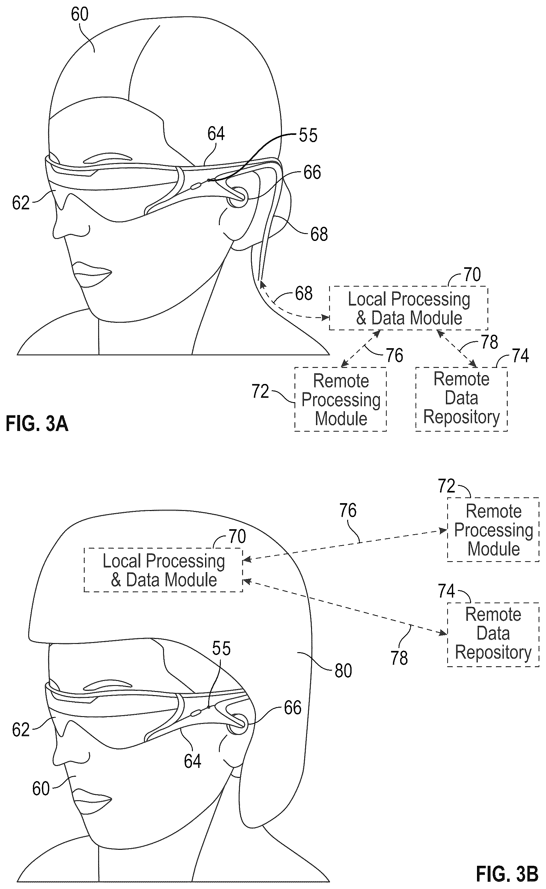 Patent US12345892 Figure 2 – Augmented and virtual reality display systems and methods for diagnosing health conditions based on visual fields