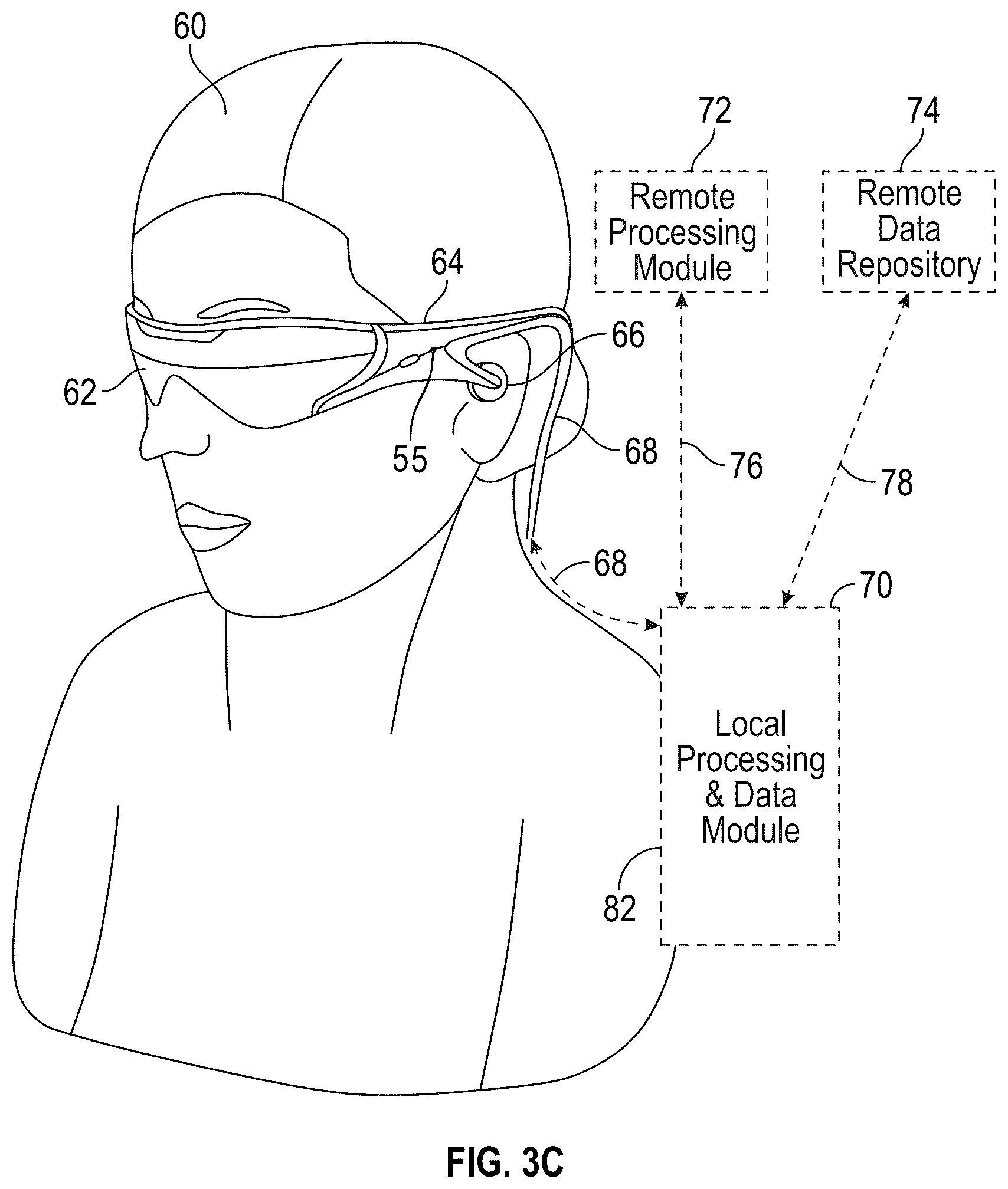 Patent US12345892 Figure 3 – Augmented and virtual reality display systems and methods for diagnosing health conditions based on visual fields