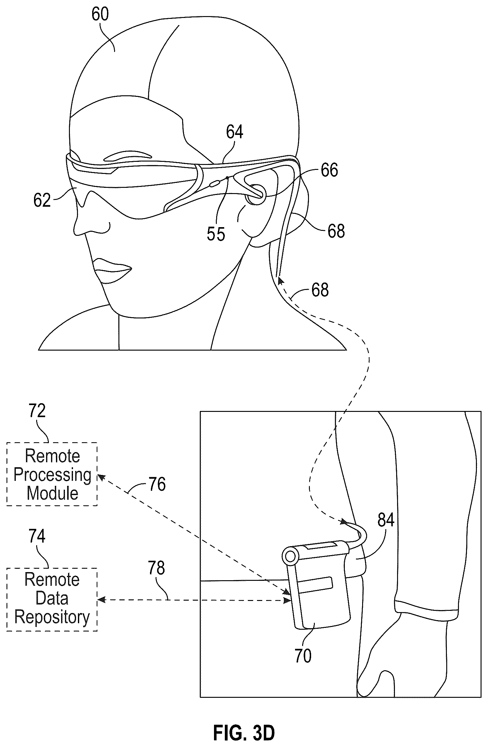 Patent US12345892 Figure 4 – Augmented and virtual reality display systems and methods for diagnosing health conditions based on visual fields