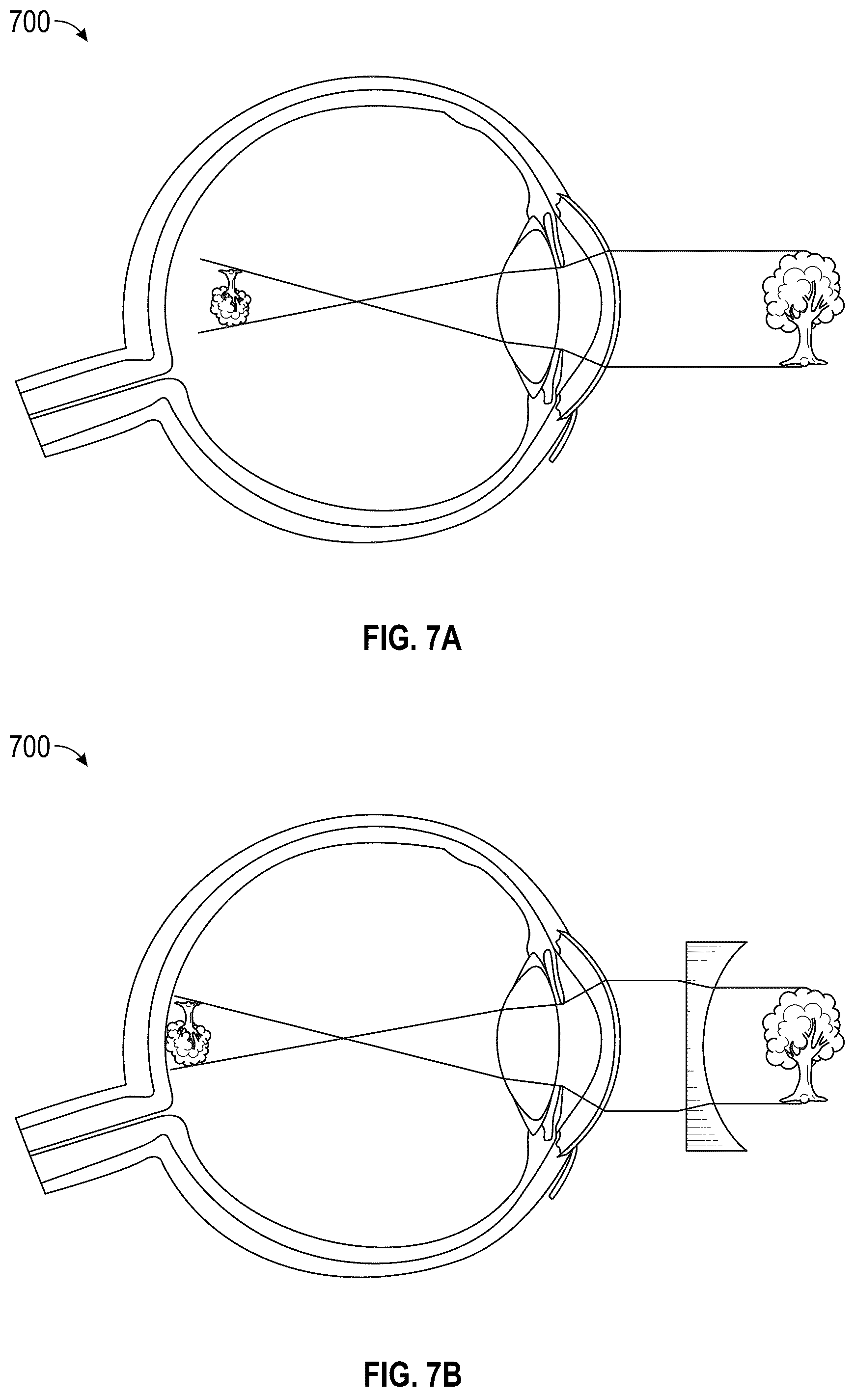 Patent US12345892 Figure 9 – Augmented and virtual reality display systems and methods for diagnosing health conditions based on visual fields