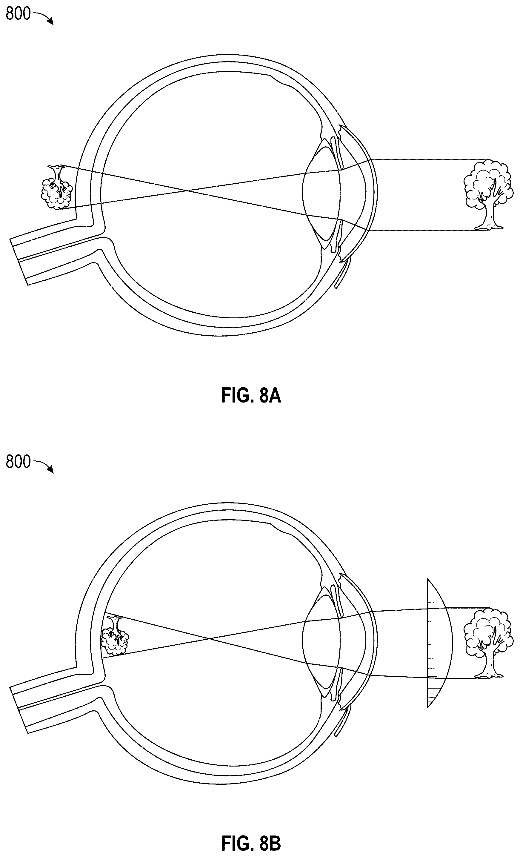 Patent US12345892 Figure 10 – Augmented and virtual reality display systems and methods for diagnosing health conditions based on visual fields