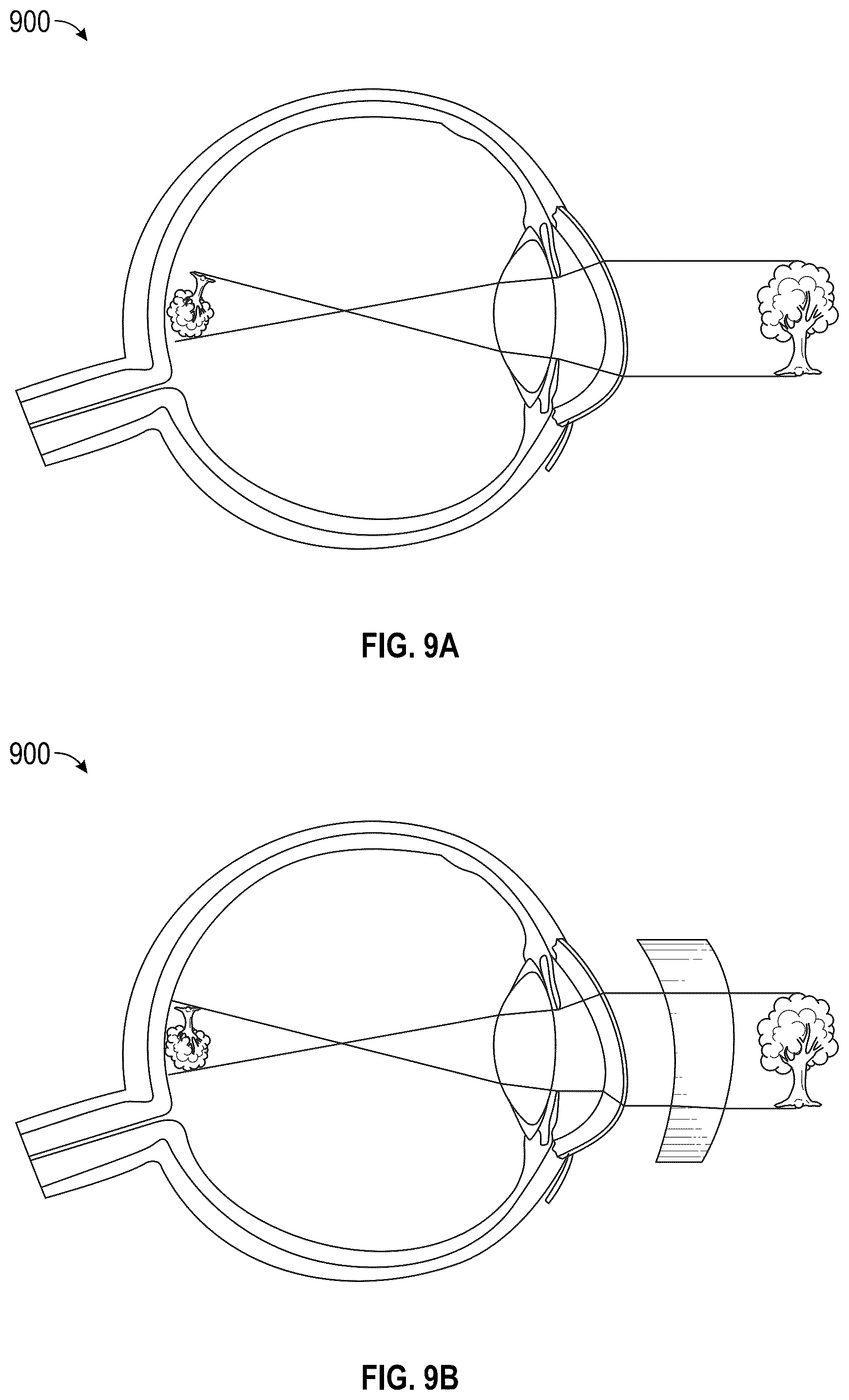 Patent US12345892 Figure 11 – Augmented and virtual reality display systems and methods for diagnosing health conditions based on visual fields