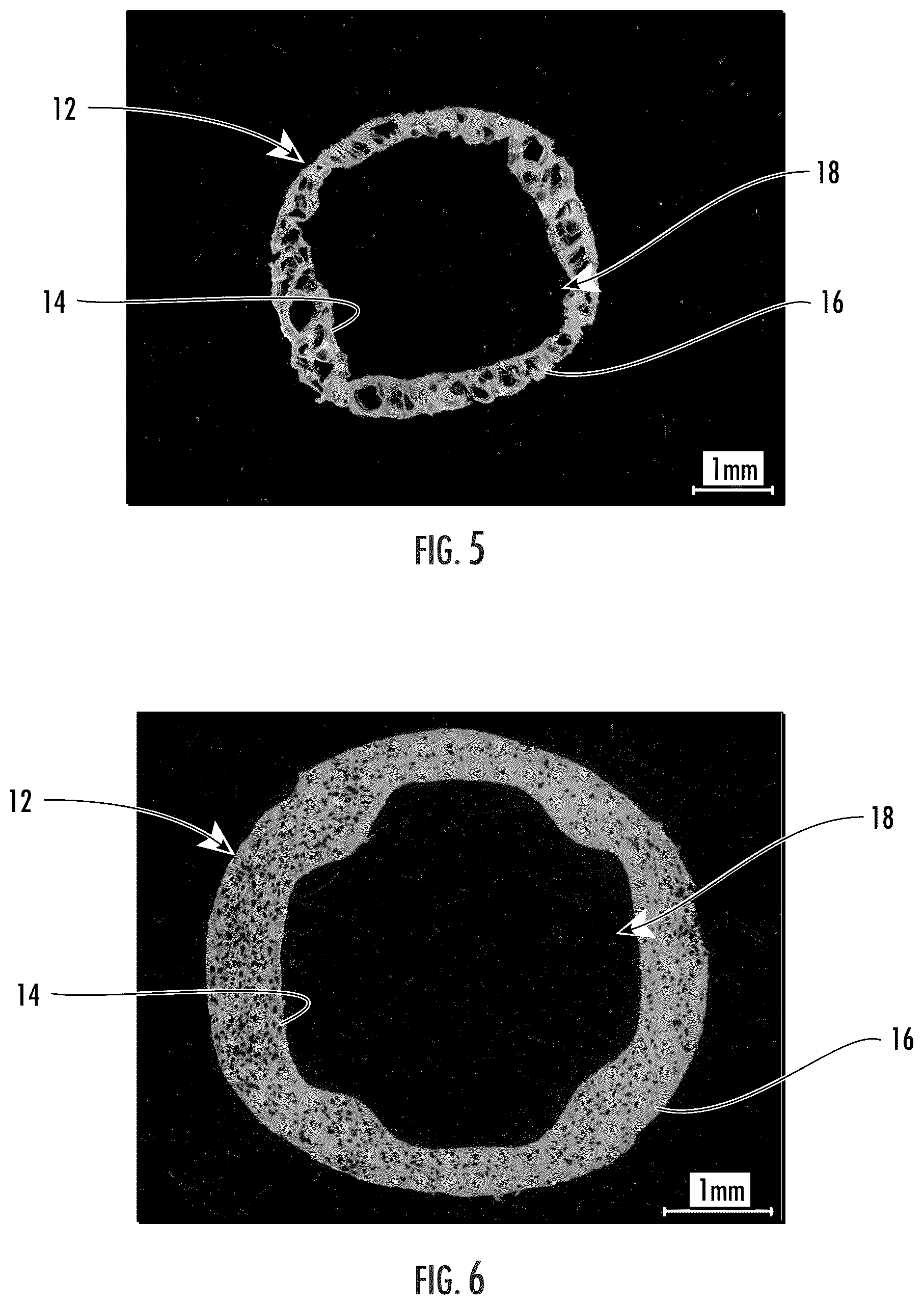 Patent US12345941 Figure 3 – Foamed tube having free space around ribbon stacks of optical fiber cable