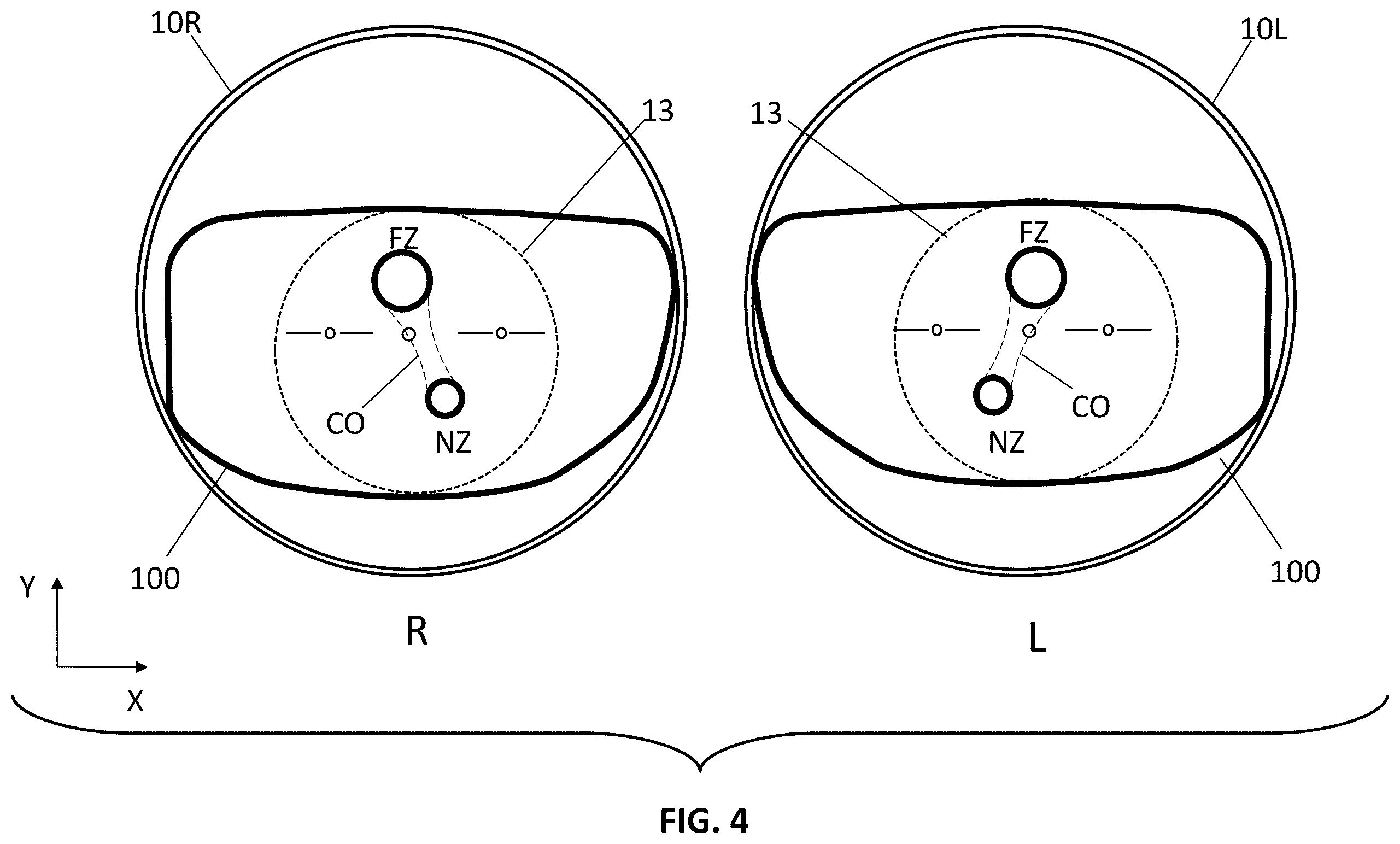 Patent US12345956 Figure 5 – Apparatus and method for projecting a pal lens in front of an eye