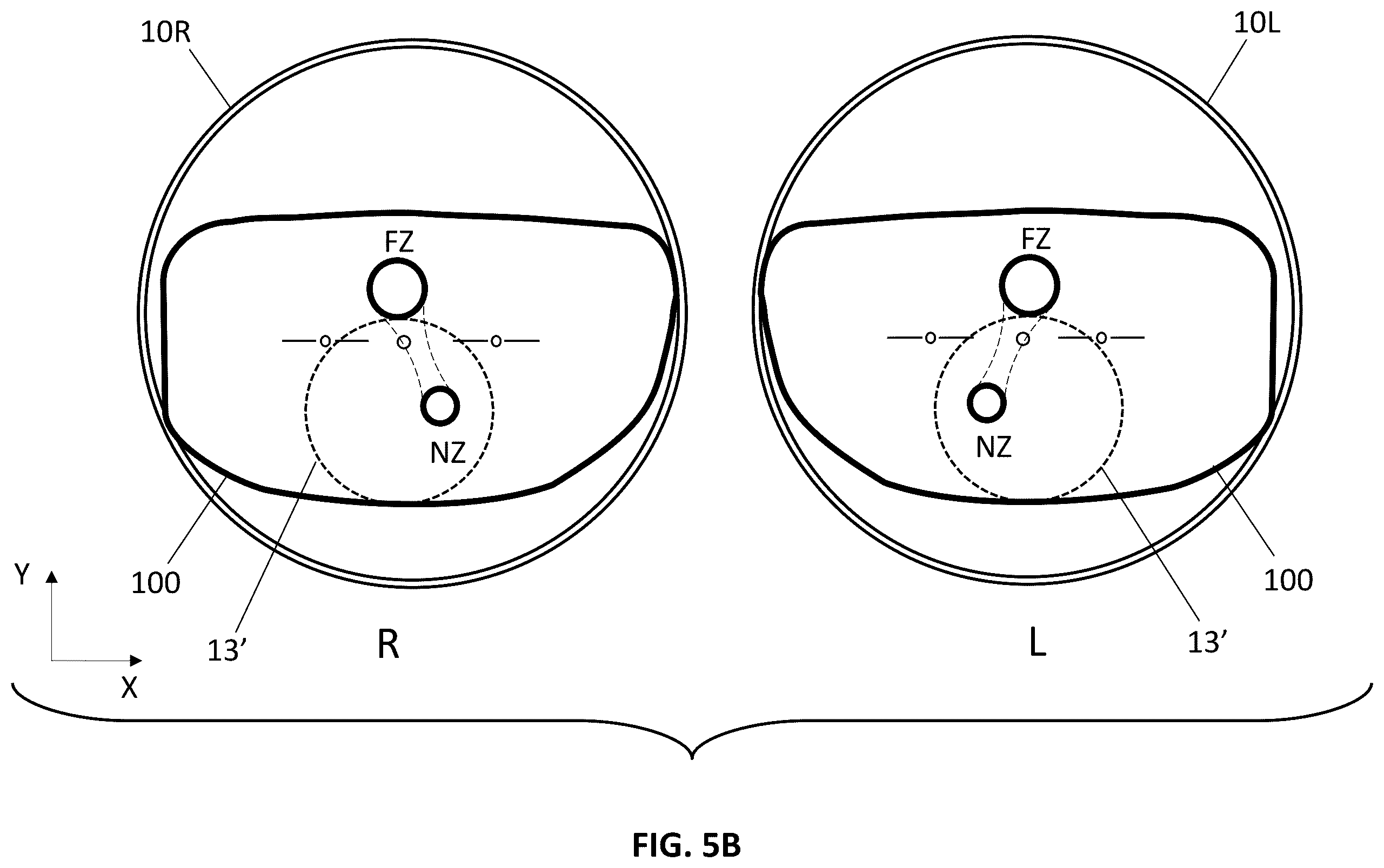 Patent US12345956 Figure 7 – Apparatus and method for projecting a pal lens in front of an eye