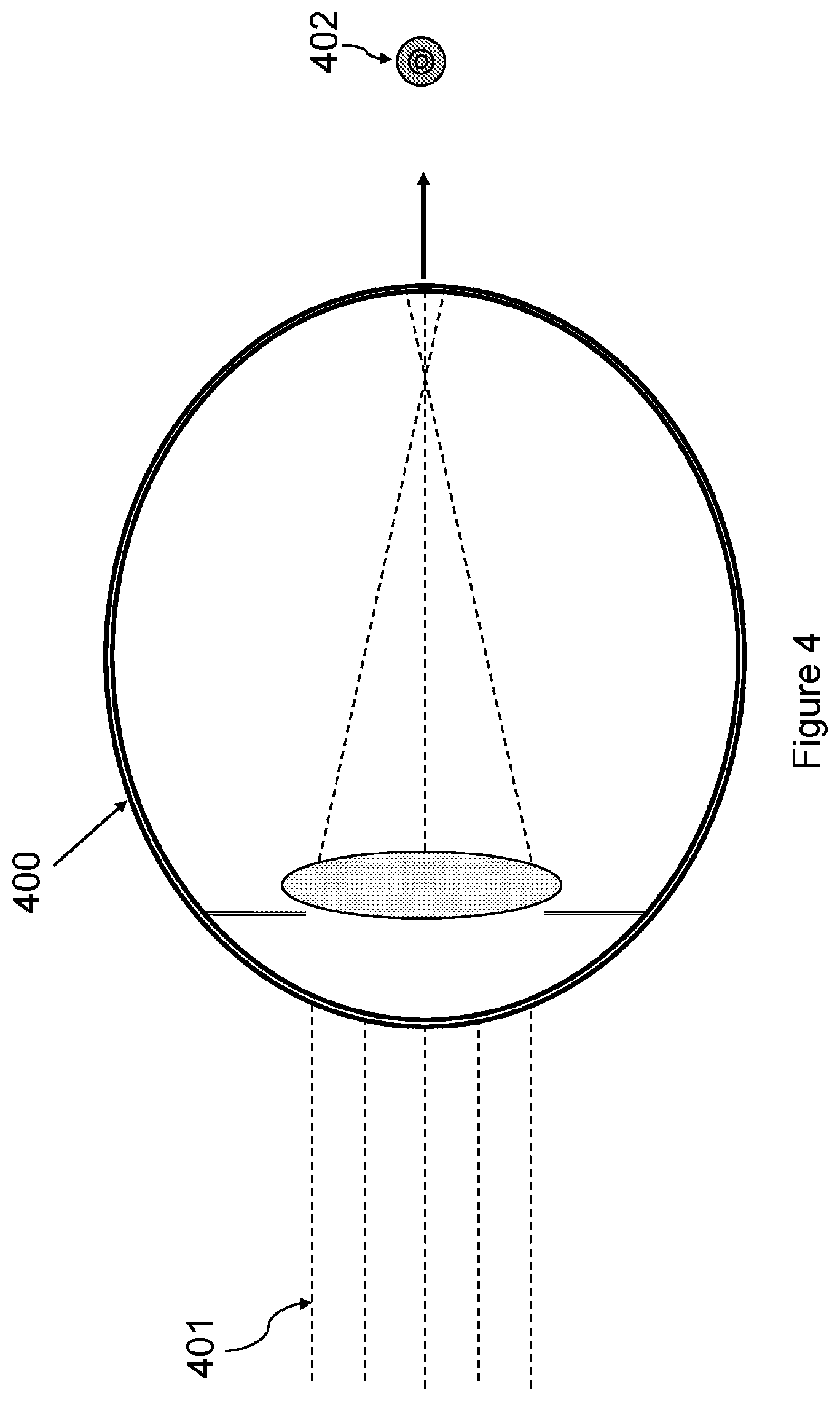 Patent US12345961 Figure 4 – Freeform contact lens solution for myopia